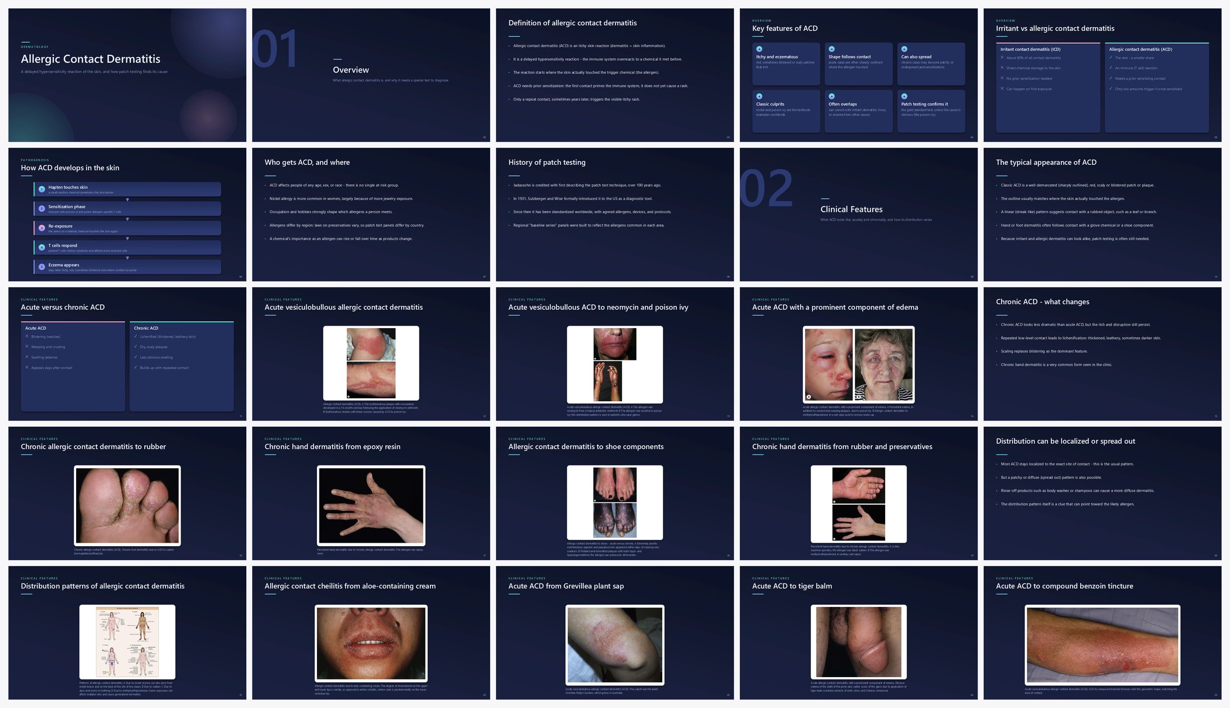 Preview of the first 25 slides of Allergic Contact Dermatitis