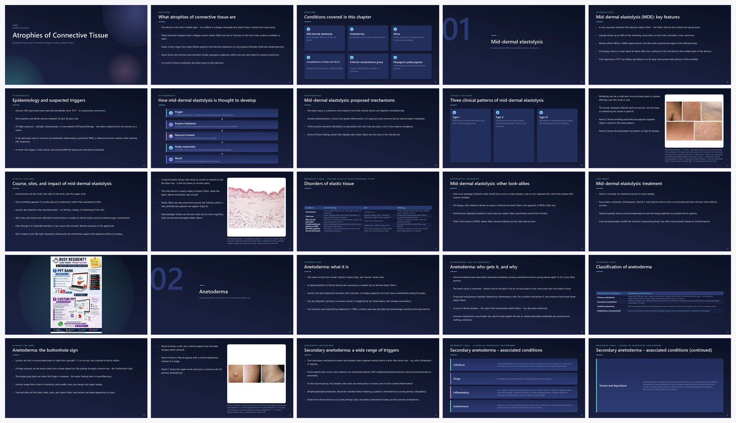 Preview of the first 25 slides of Atrophies of Connective Tissue