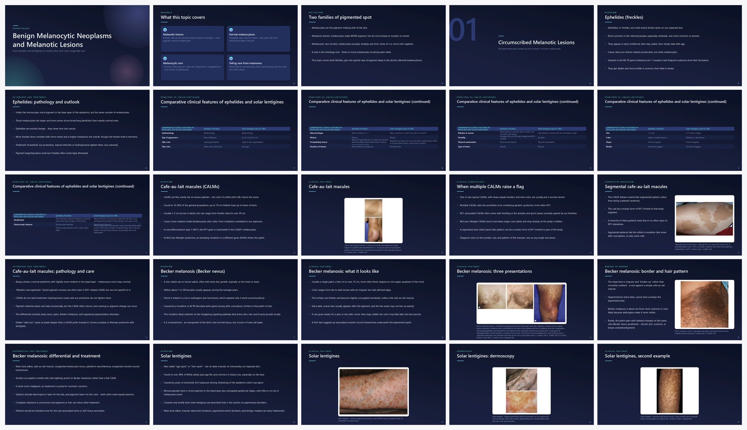 Preview of the first 25 slides of Benign Melanocytic Neoplasms and Melanotic Lesions