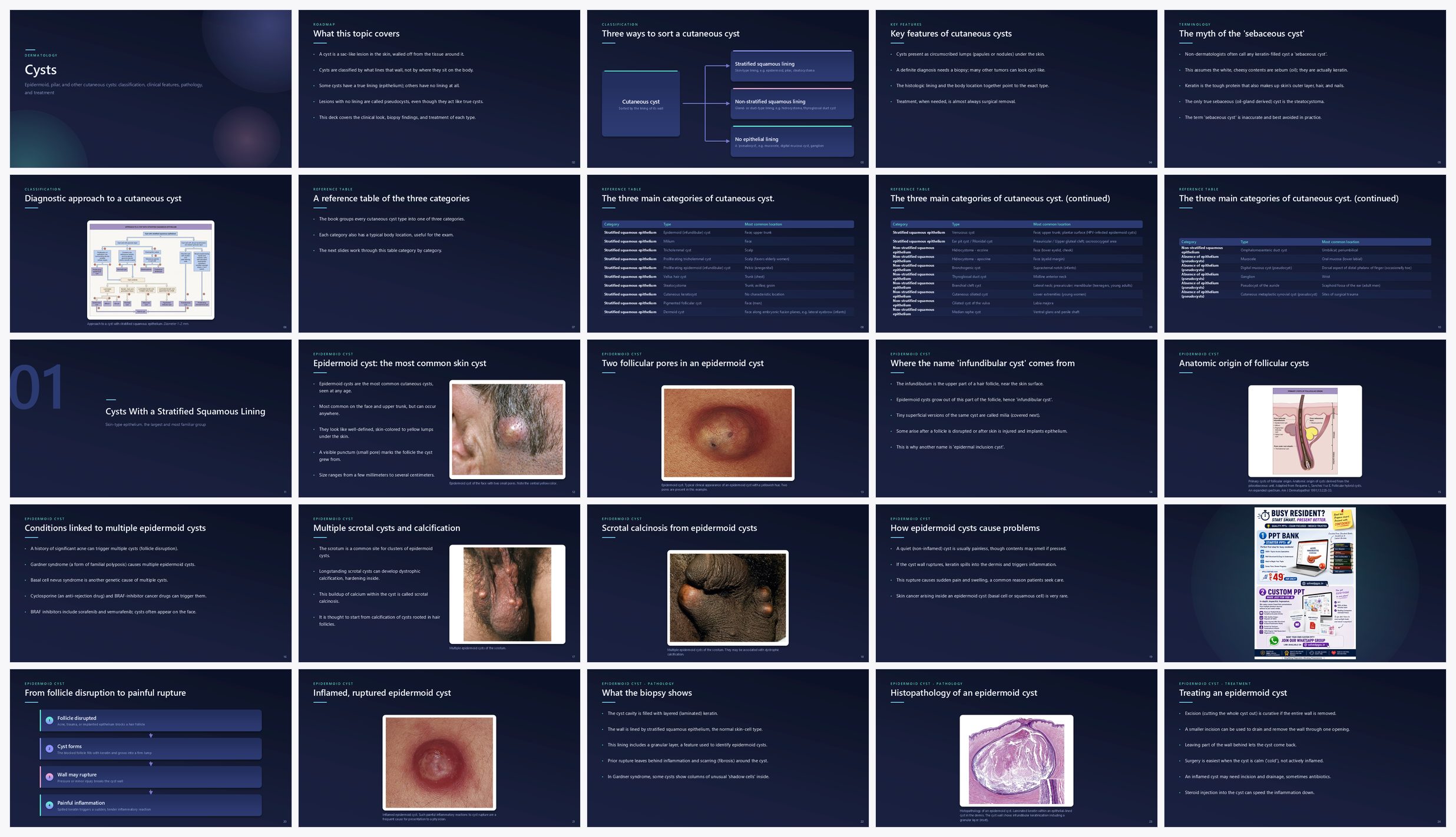 Preview of the first 25 slides of Cysts