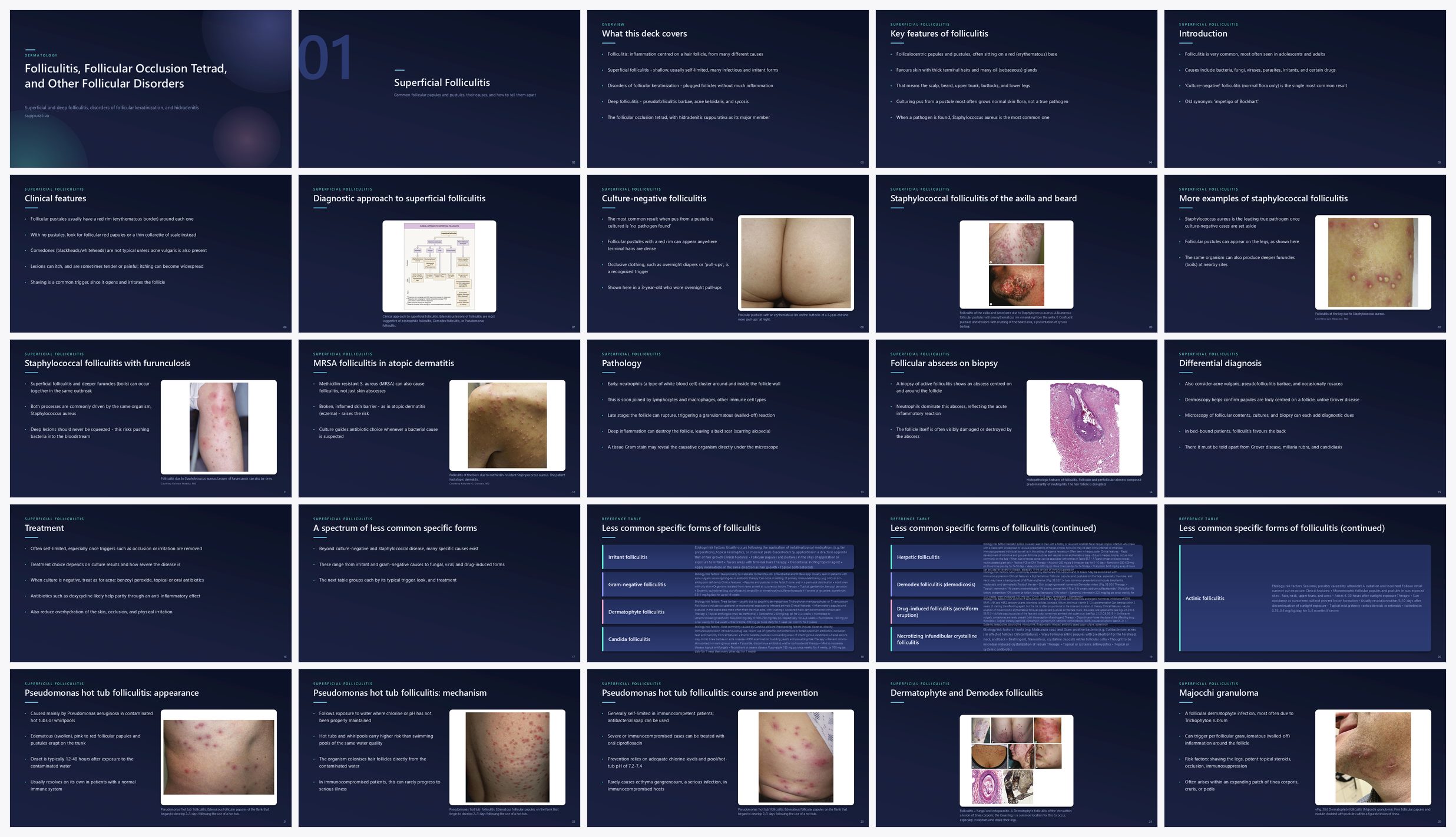 Preview of the first 25 slides of Folliculitis, Follicular Occlusion Tetrad, and Other Follicular Disorders