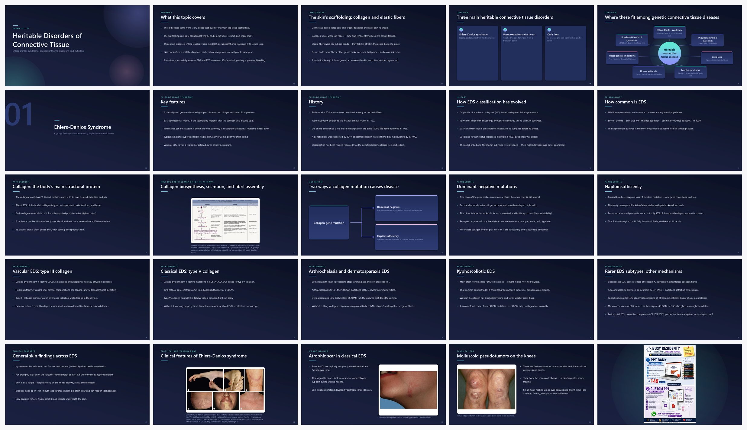 Preview of the first 25 slides of Heritable Disorders of Connective Tissue