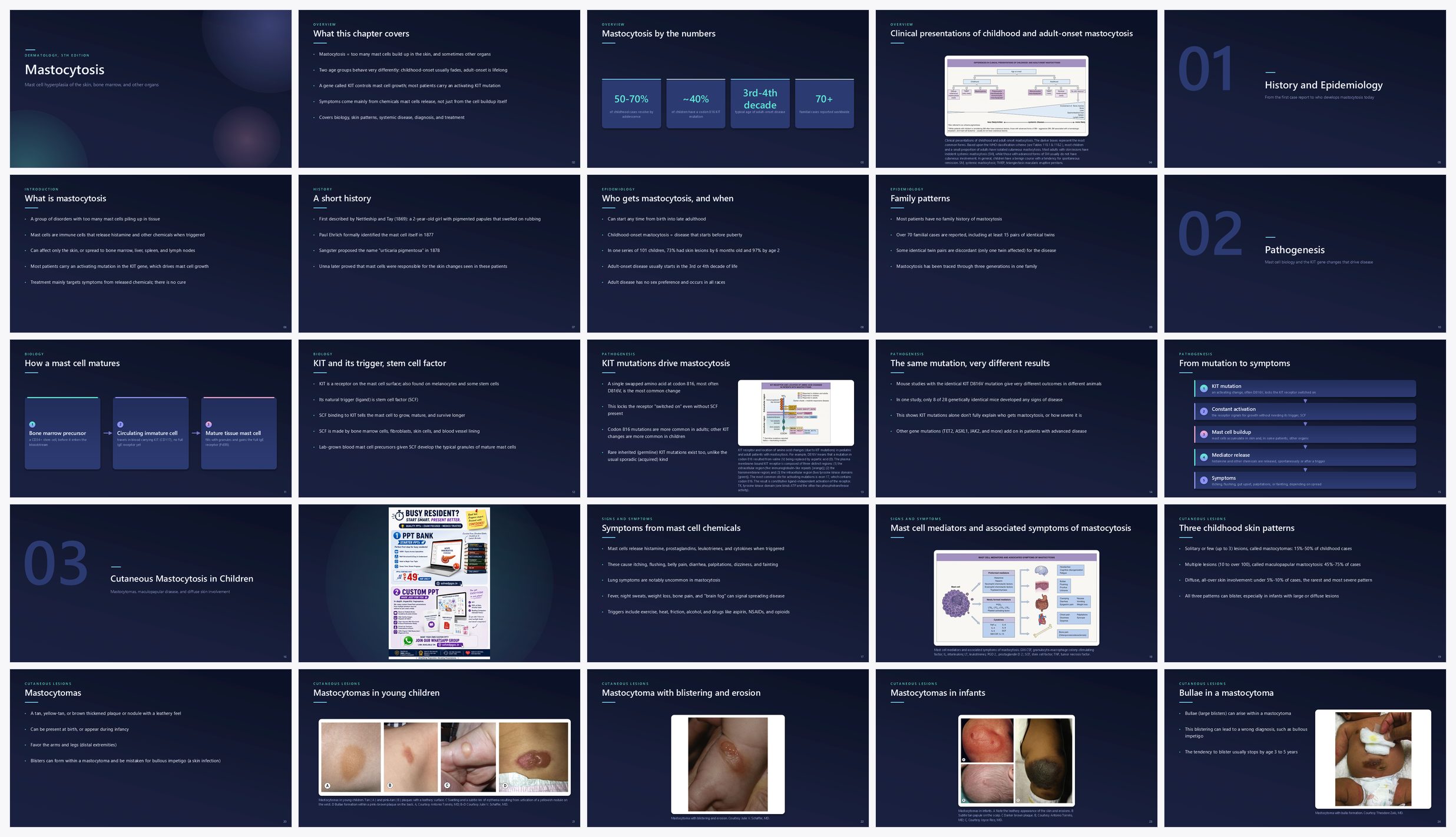Preview of the first 25 slides of Mastocytosis