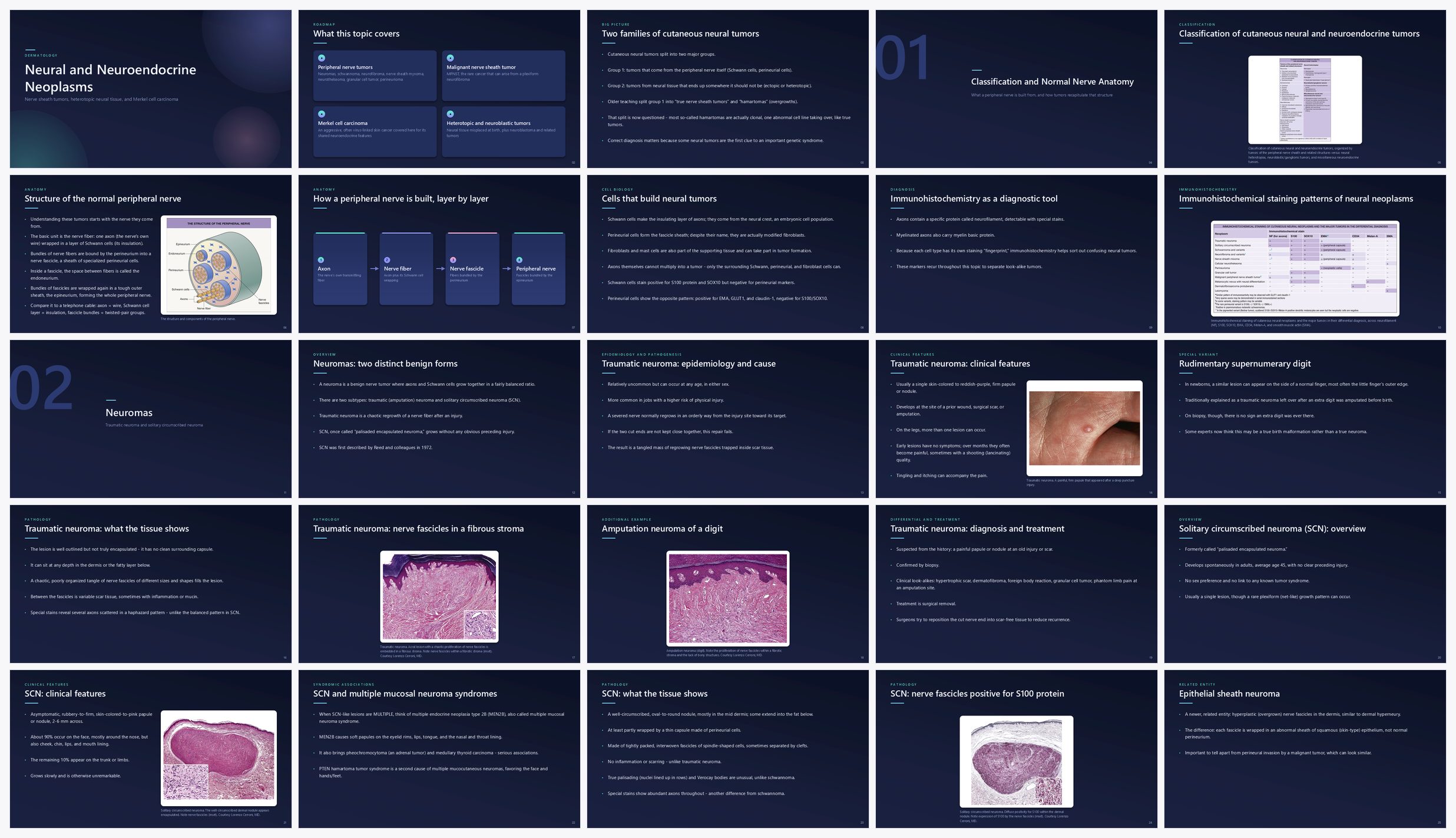 Preview of the first 25 slides of Neural and Neuroendocrine Neoplasms (Other Than Neurofibromatosis)