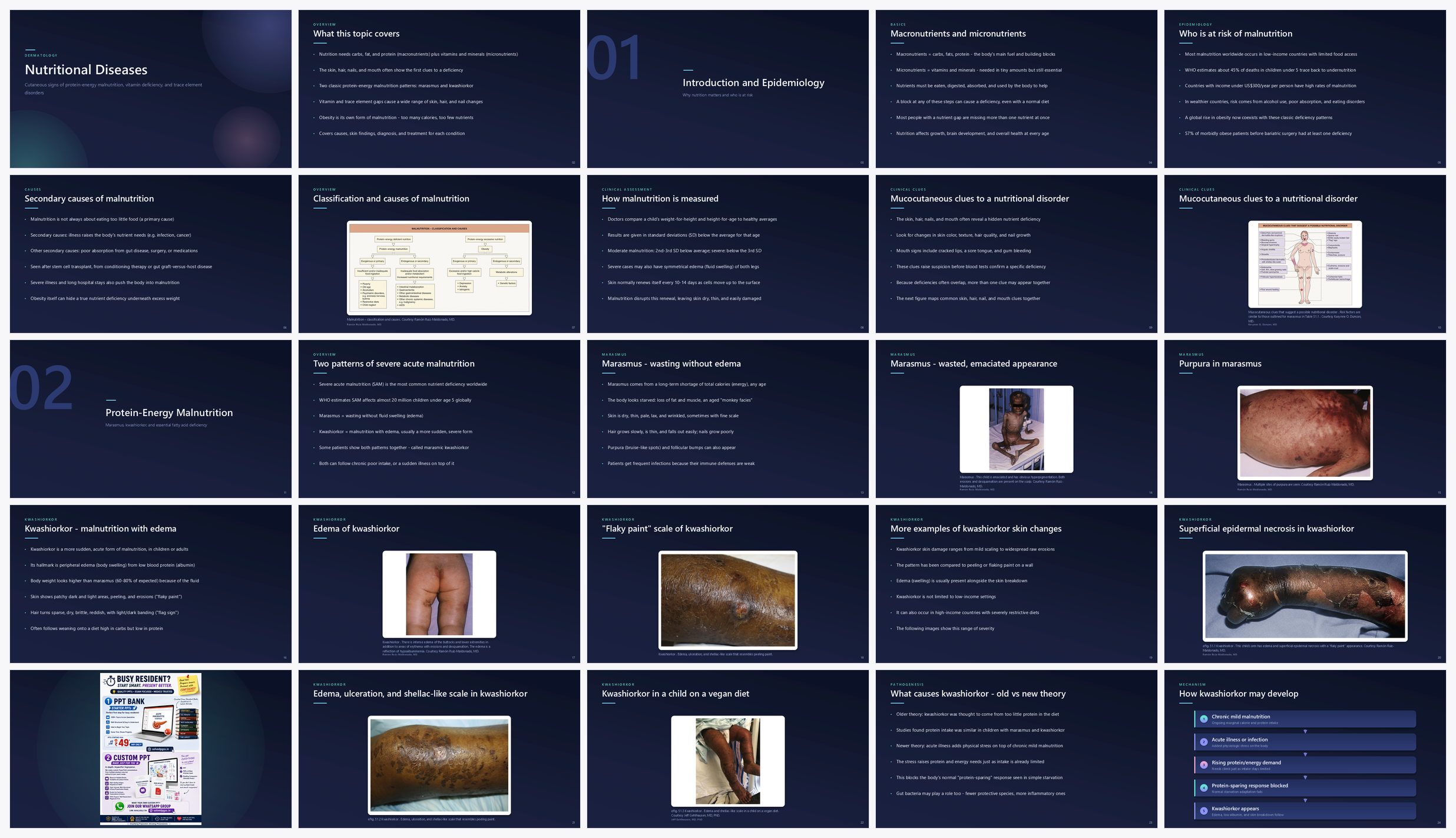 Preview of the first 25 slides of Nutritional Diseases