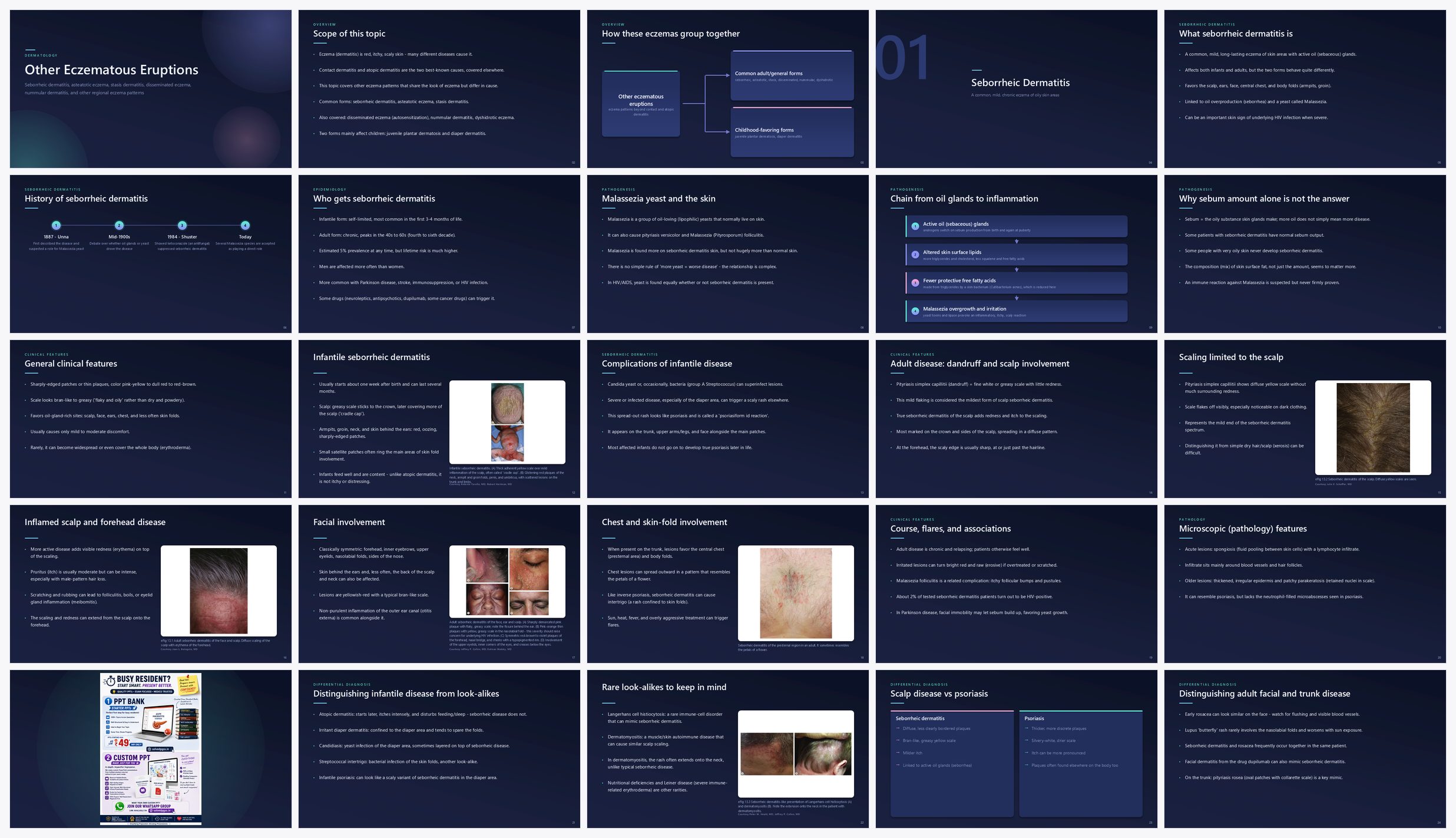 Preview of the first 25 slides of Other Eczematous Eruptions