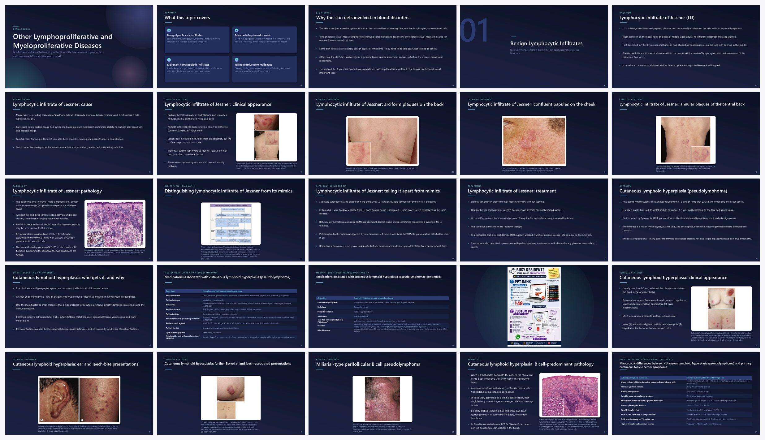 Preview of the first 25 slides of Other Lymphoproliferative and Myeloproliferative Diseases
