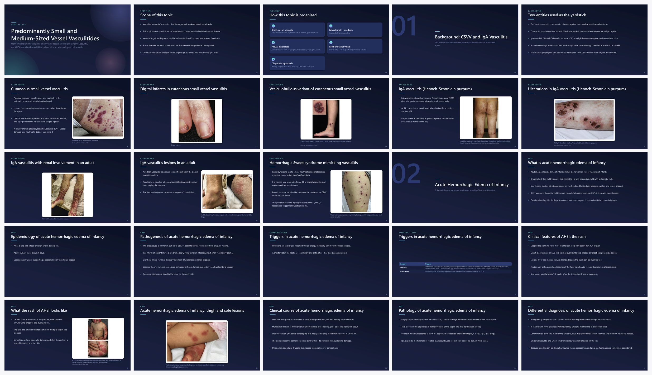 Preview of the first 25 slides of PREDOMINANTLY SMALL AND MEDIUM-SIZED VESSEL VASCULITIDES