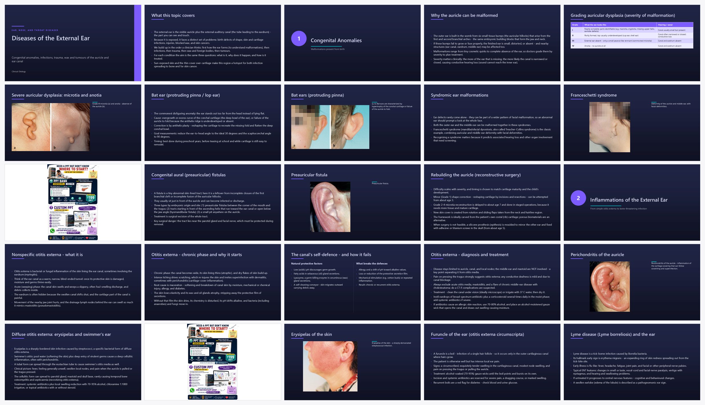 Preview of the first 25 slides of Ear Clinical Aspects of Diseases of the External Ear