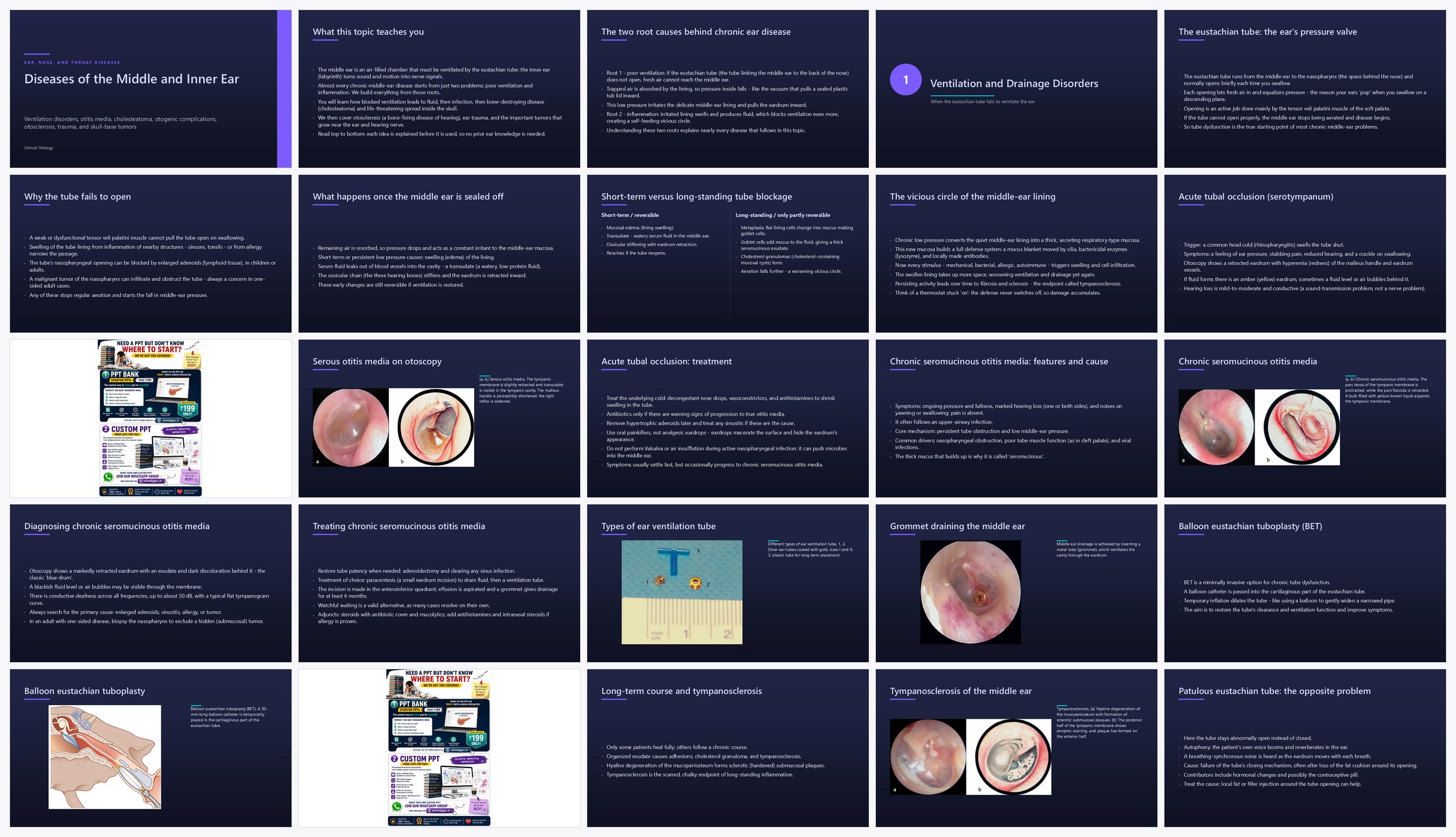 Preview of the first 25 slides of Ear Clinical Aspects of Diseases of the Middle and Inner E