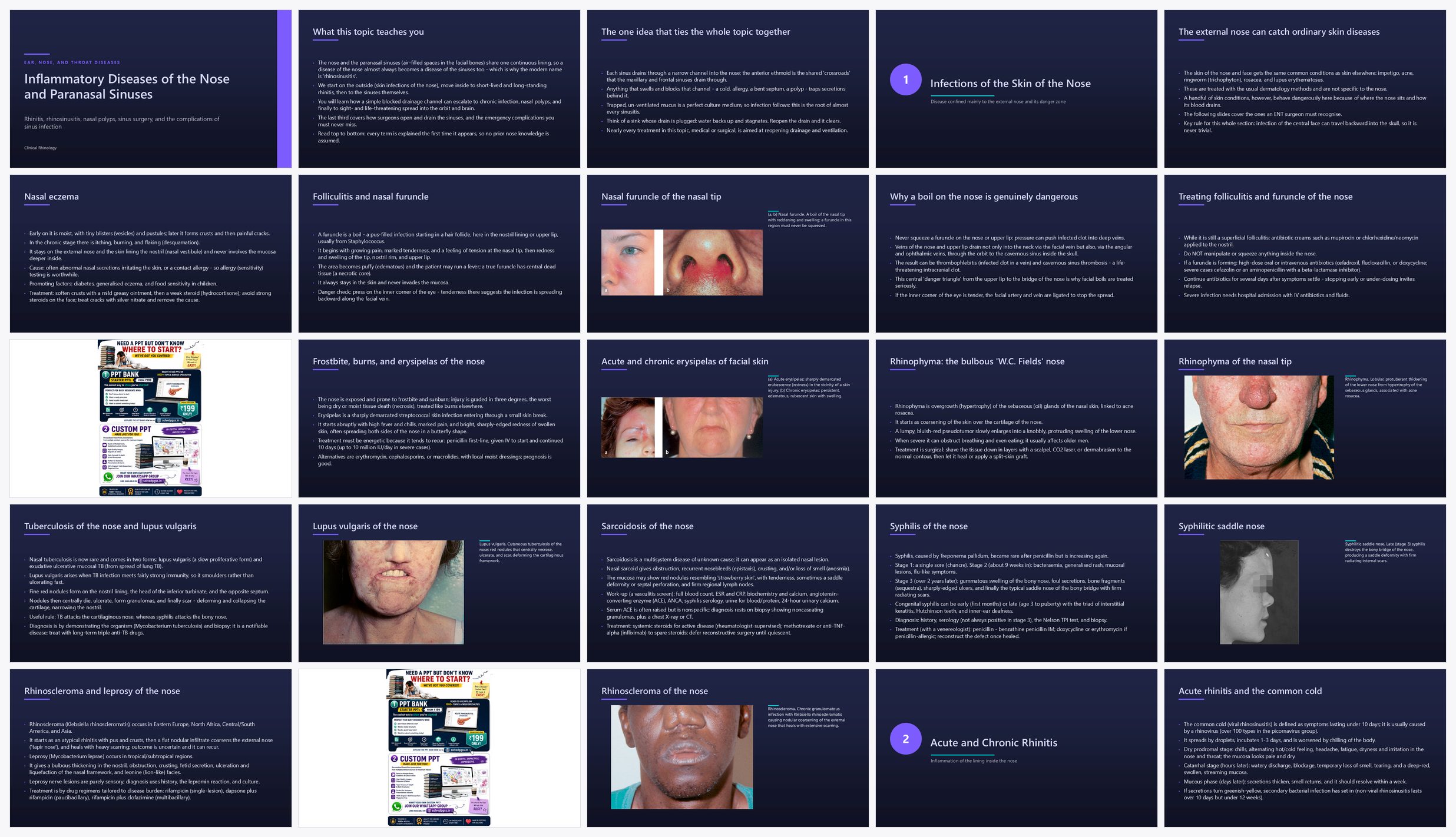 Preview of the first 25 slides of Rhinitis, rhinosinusitis, nasal polyps, sinus surgery, and the complications of sinus infection