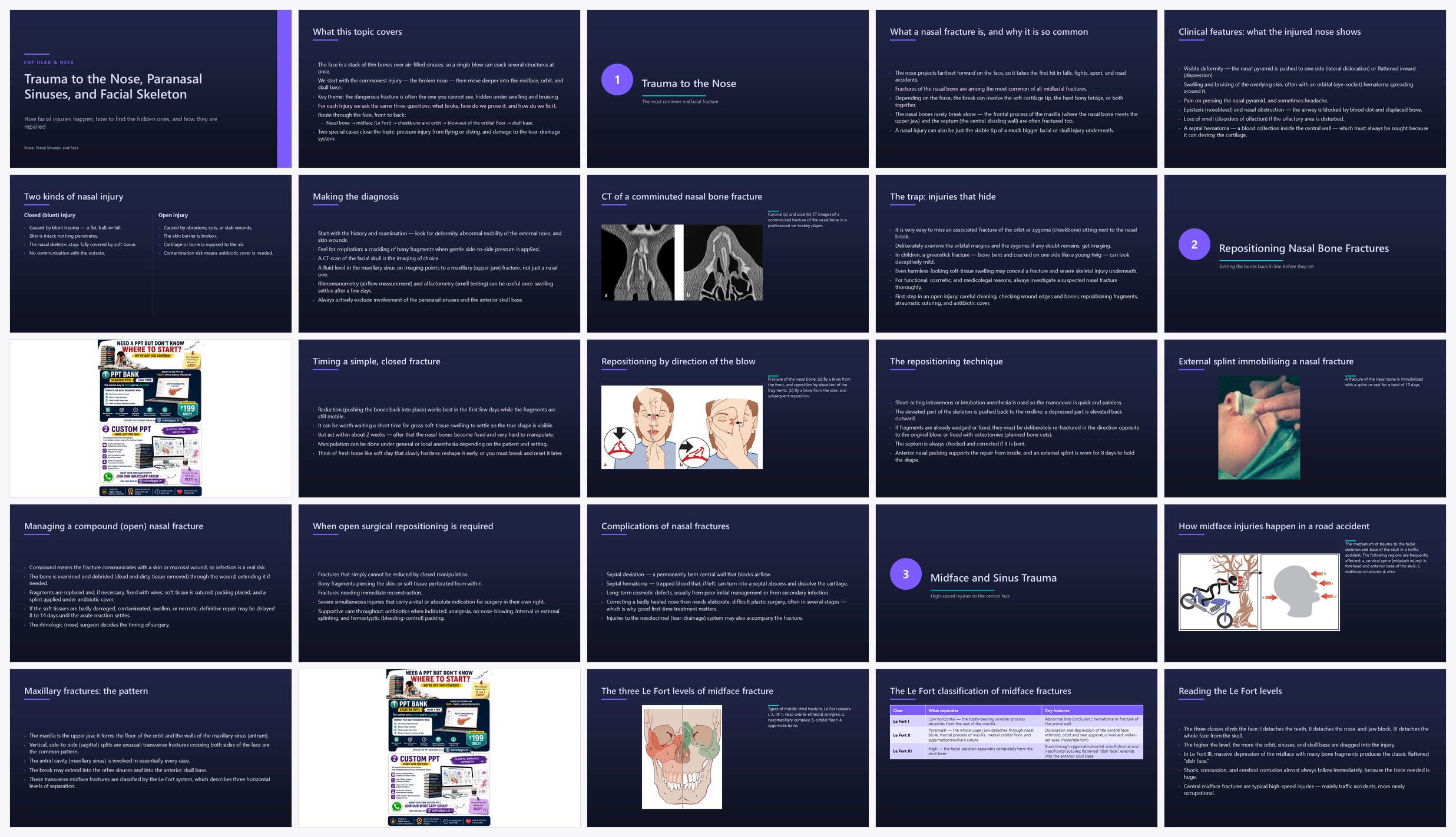 Preview of the first 25 slides of Trauma to the Nose, Paranasal Sinuses, and Facial Skeleton