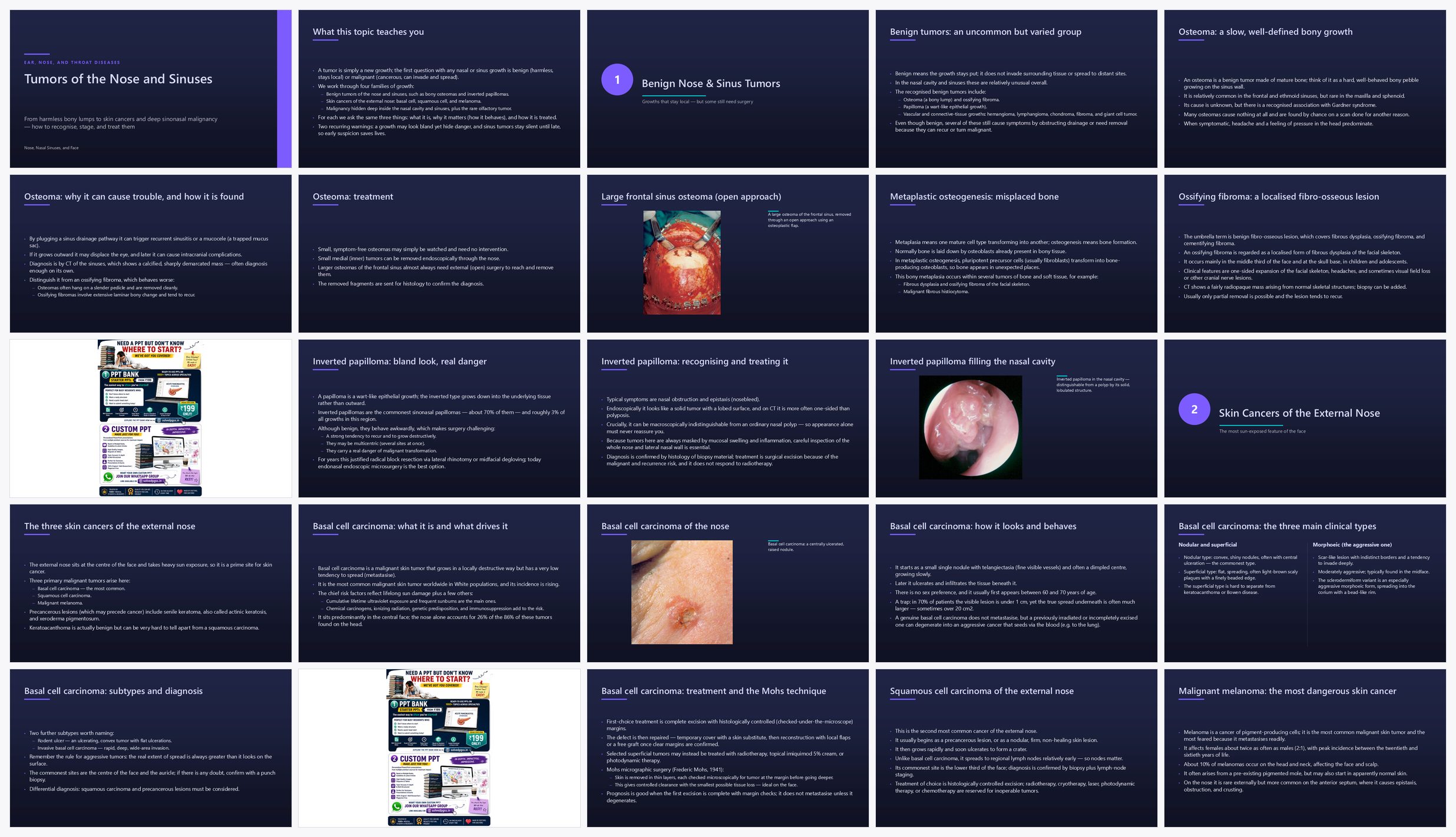 Preview of the first 25 slides of Tumors of the Nose and Sinuses