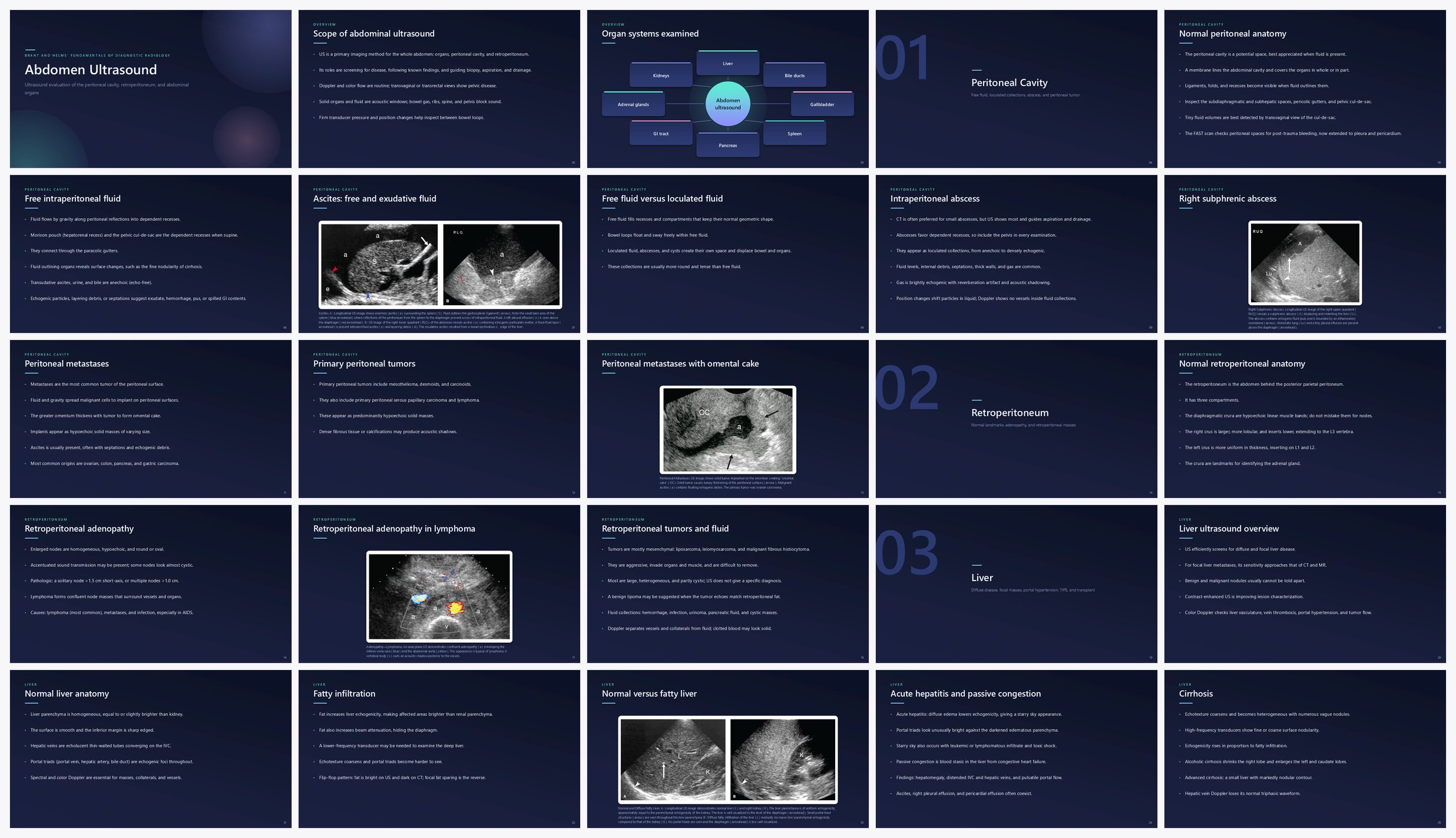 Preview of the first 25 slides of Abdomen Ultrasound