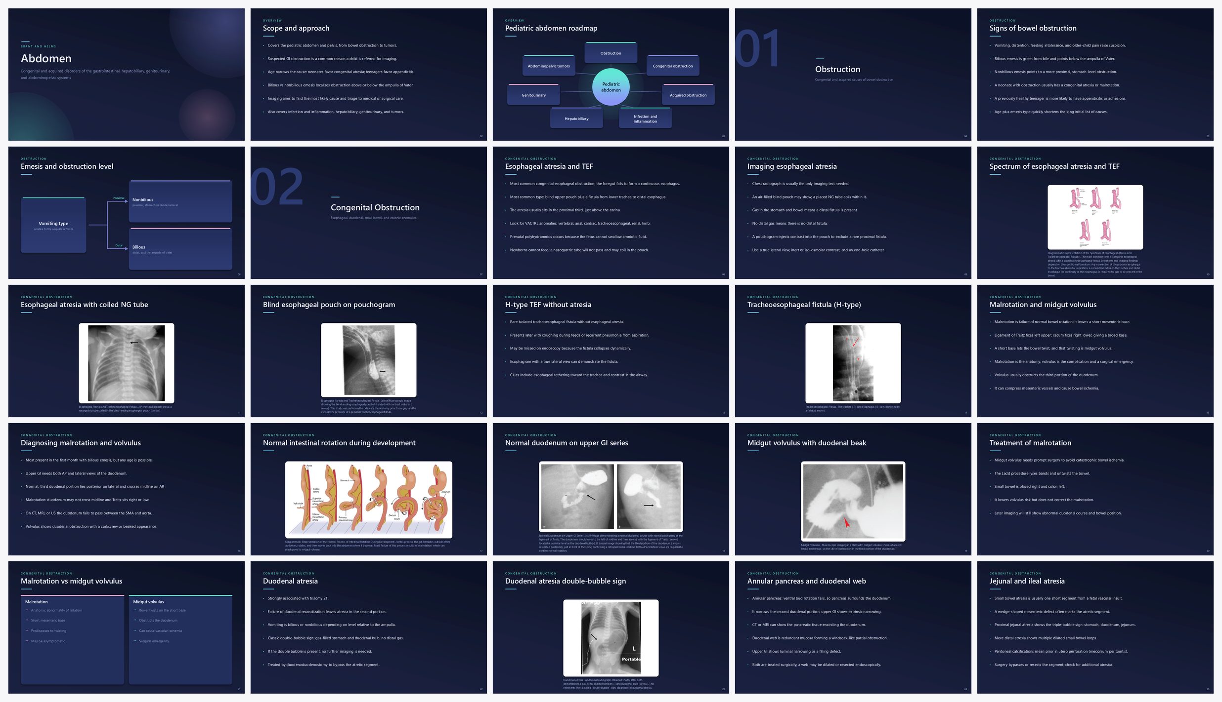 Preview of the first 25 slides of Abdomen
