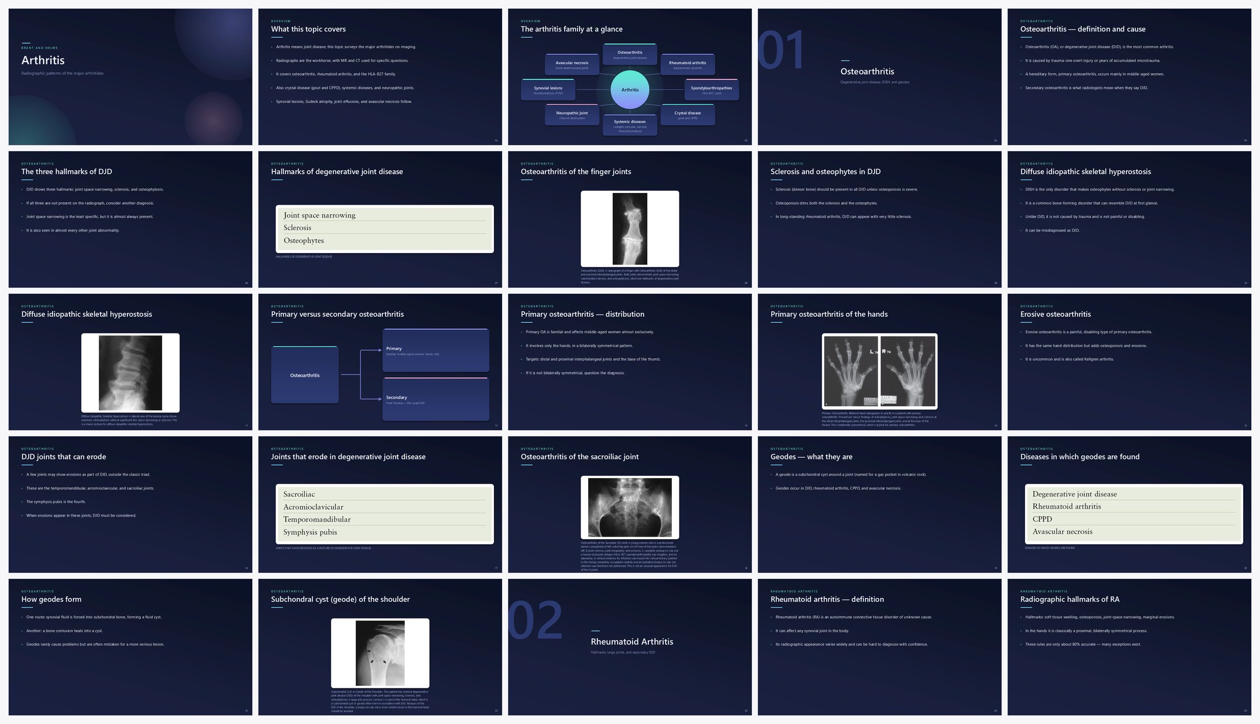 Preview of the first 25 slides of Arthritis