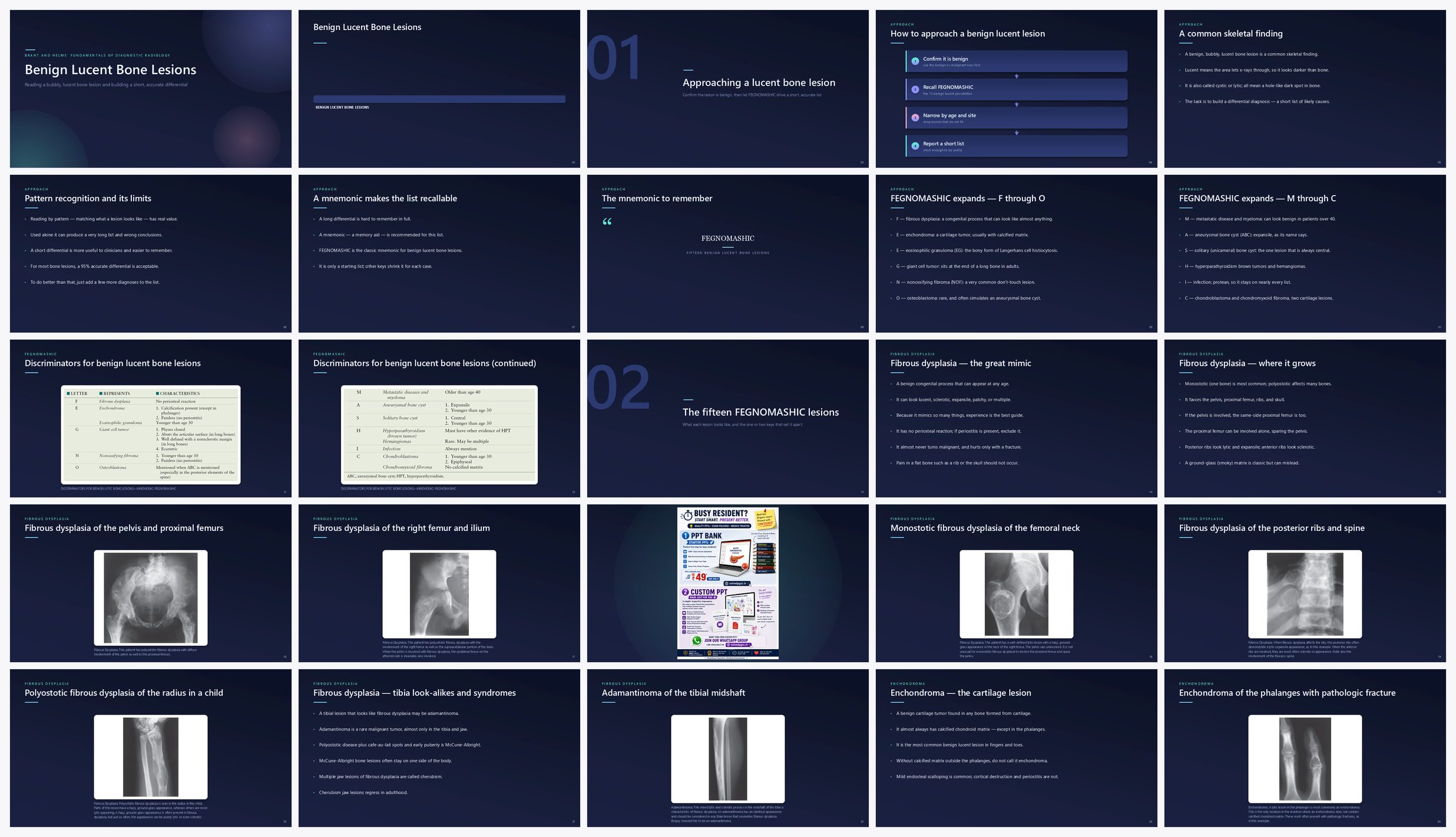 Preview of the first 25 slides of Benign Lucent Bone Lesions