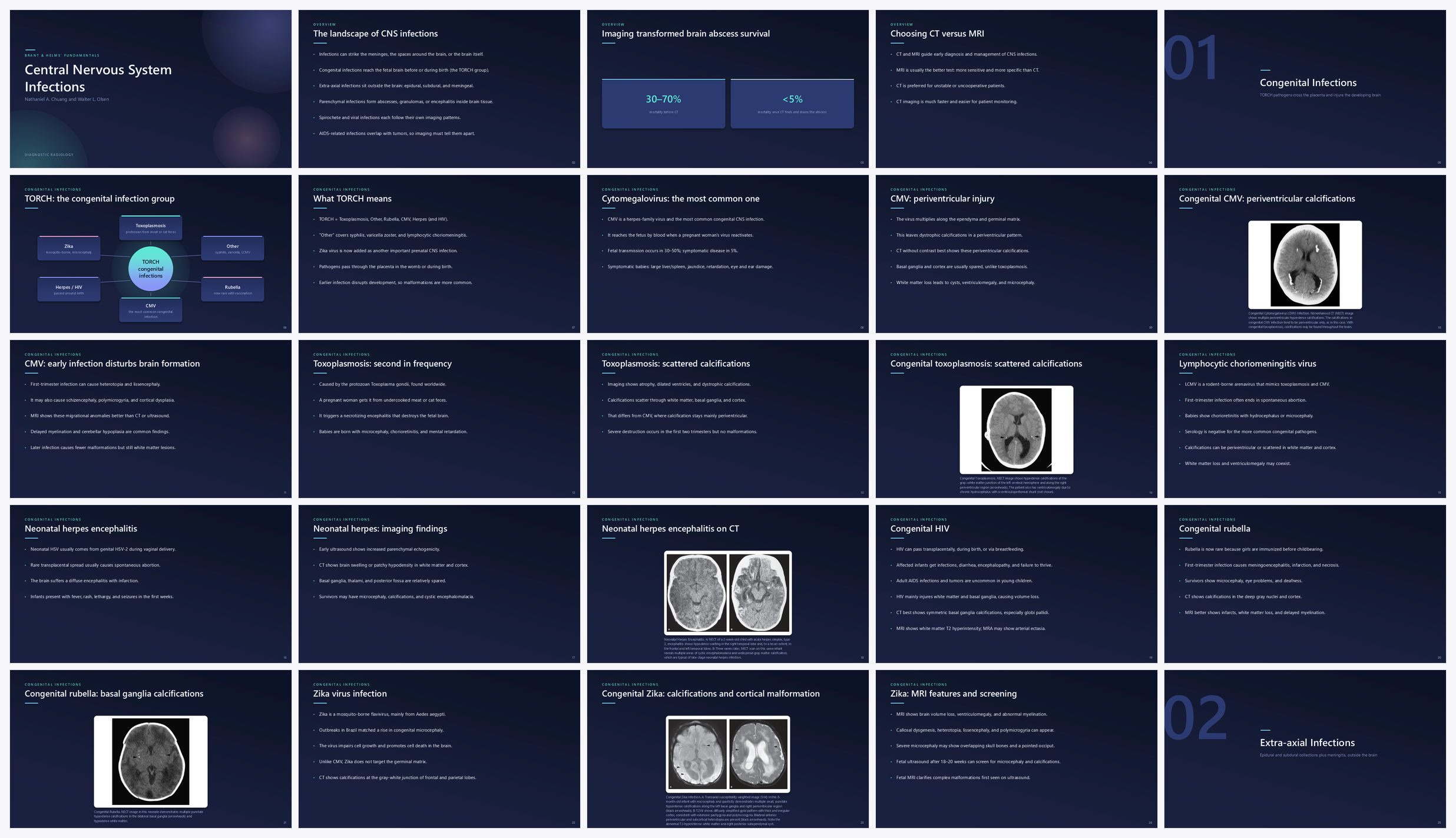 Preview of the first 25 slides of Central Nervous System Infections