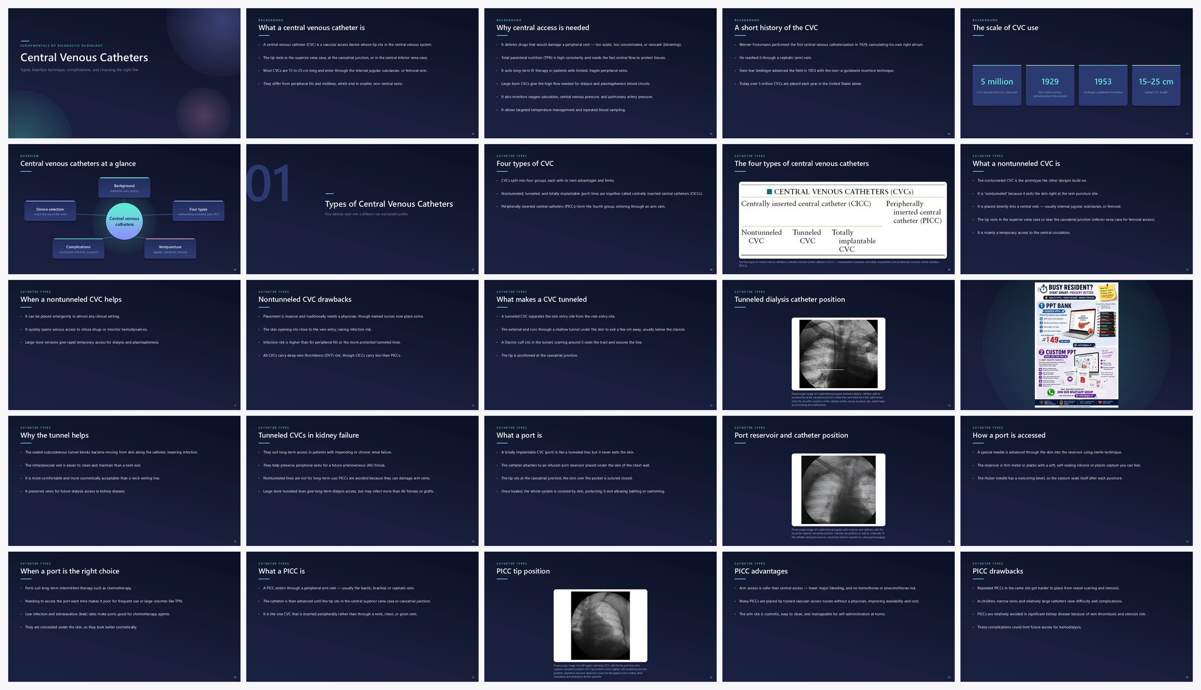 Preview of the first 25 slides of Central Venous Catheters