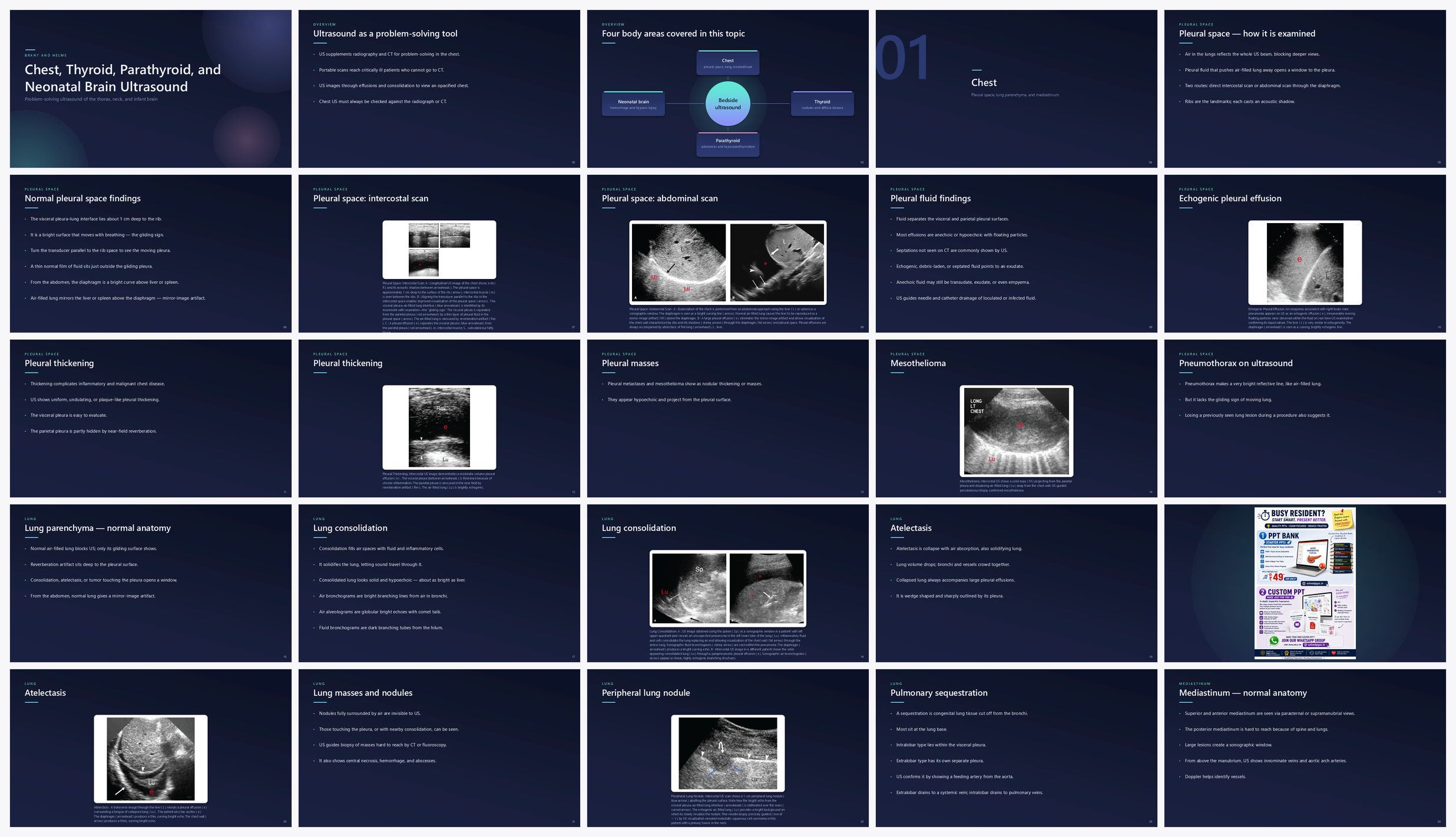 Preview of the first 25 slides of Chest, Thyroid, Parathyroid, and Neonatal Brain Ultrasound