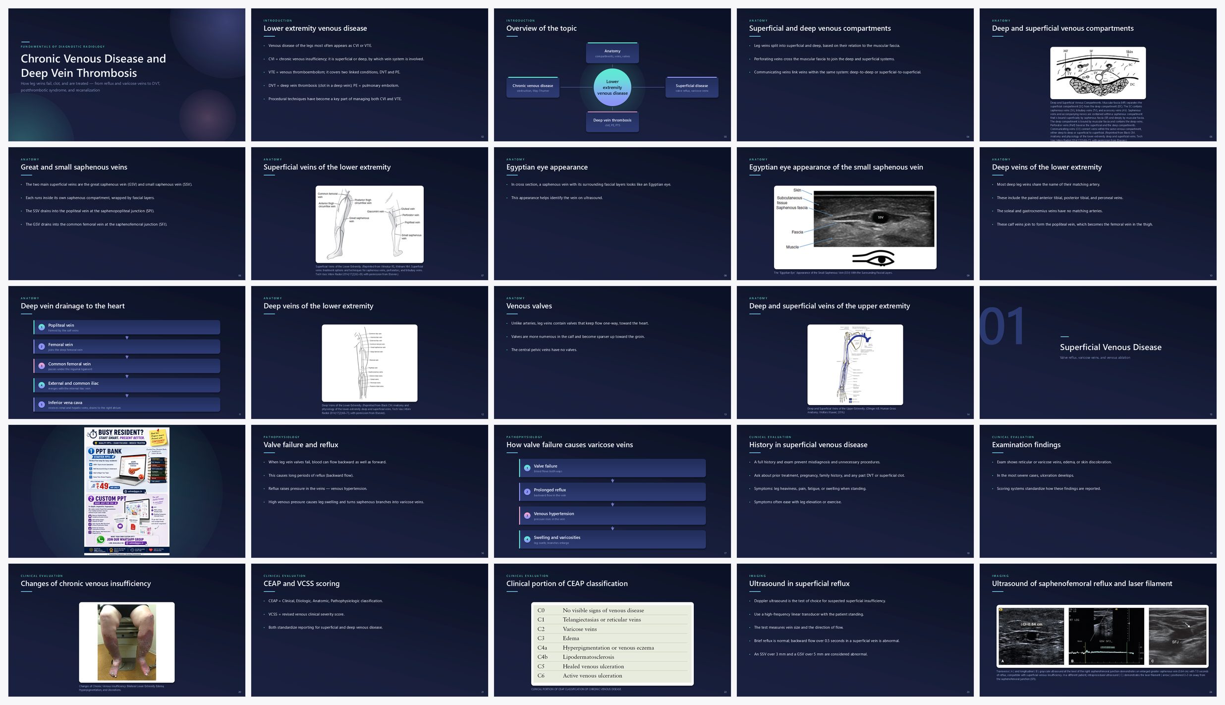 Preview of the first 25 slides of Chronic Venous Disease and Deep Vein Thrombosis