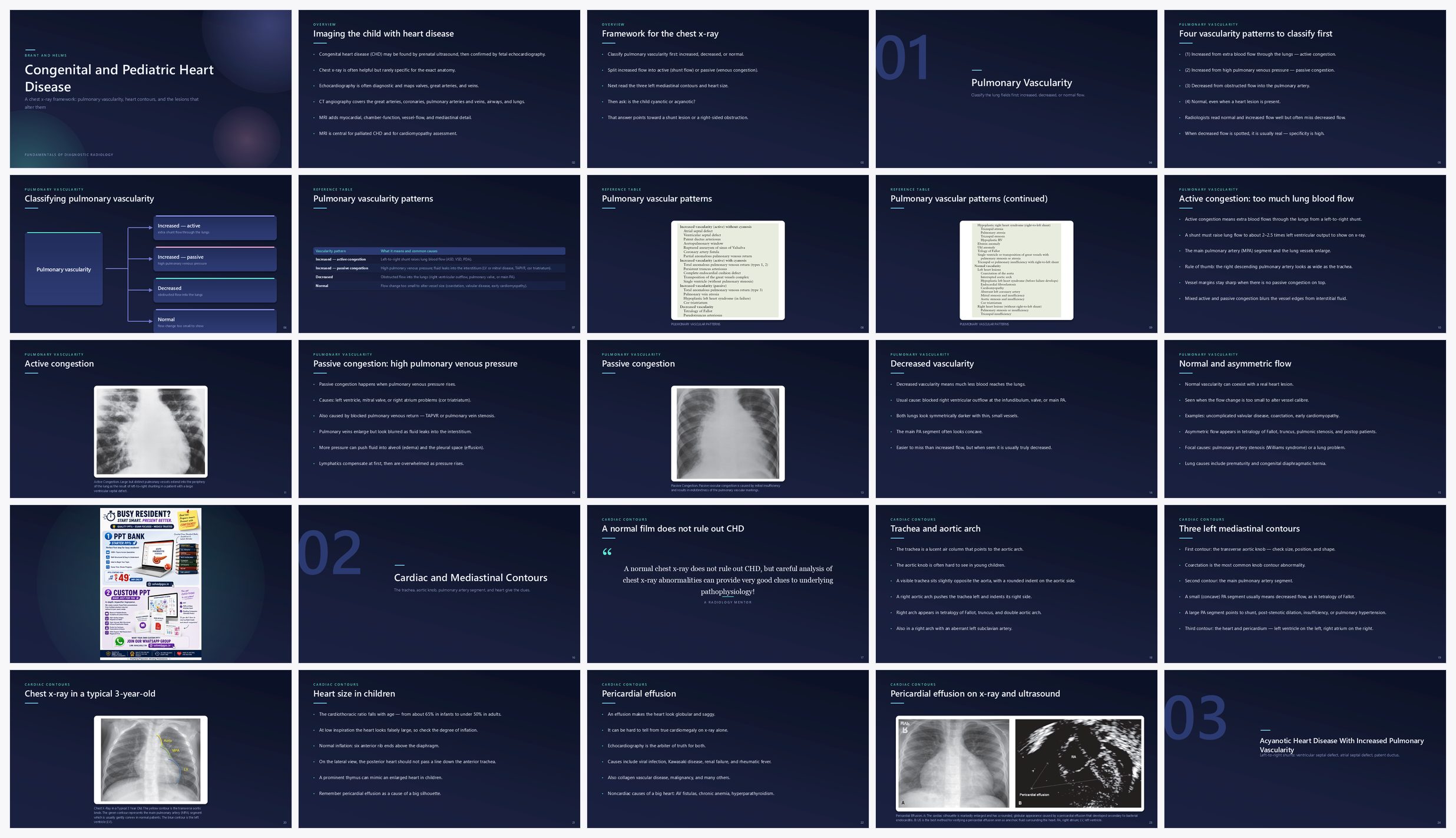 Preview of the first 25 slides of Congenital and Pediatric Heart Disease
