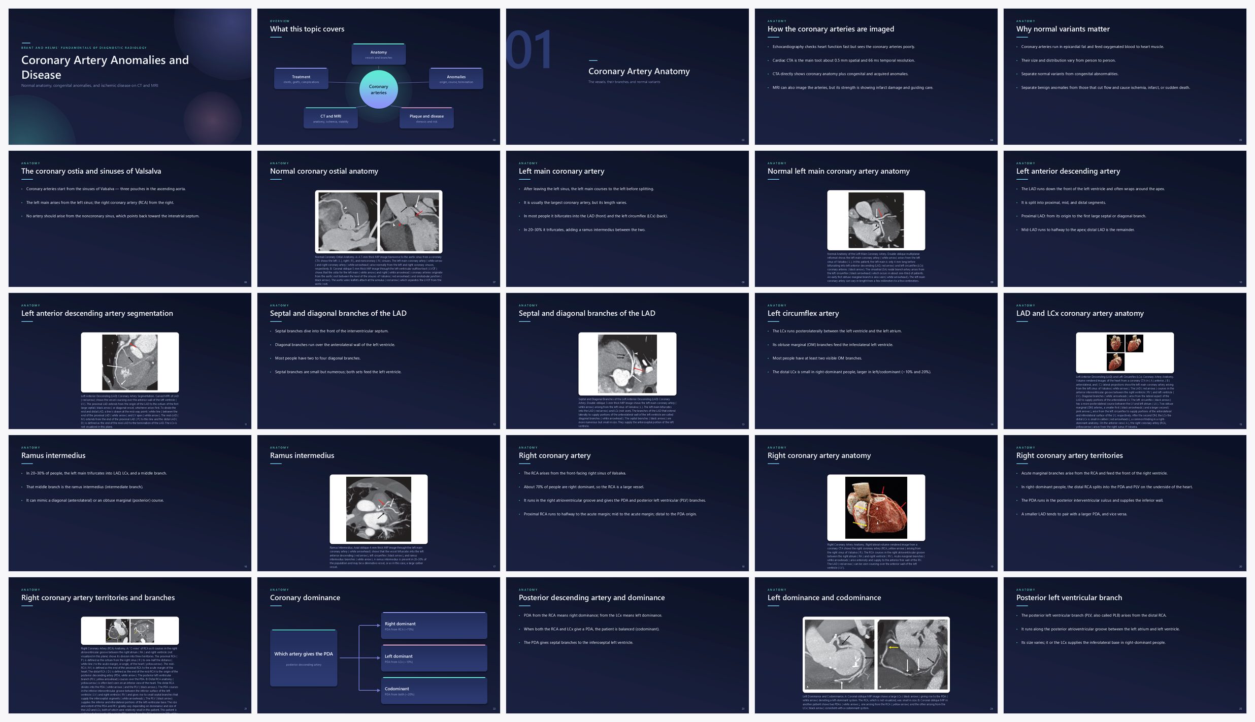 Preview of the first 25 slides of Coronary Artery Anomalies and Disease