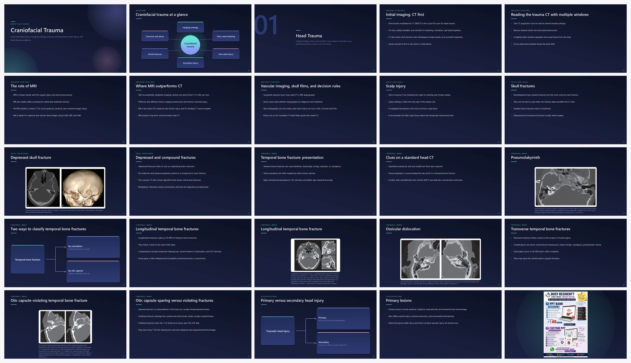 Preview of the first 25 slides of Craniofacial Trauma
