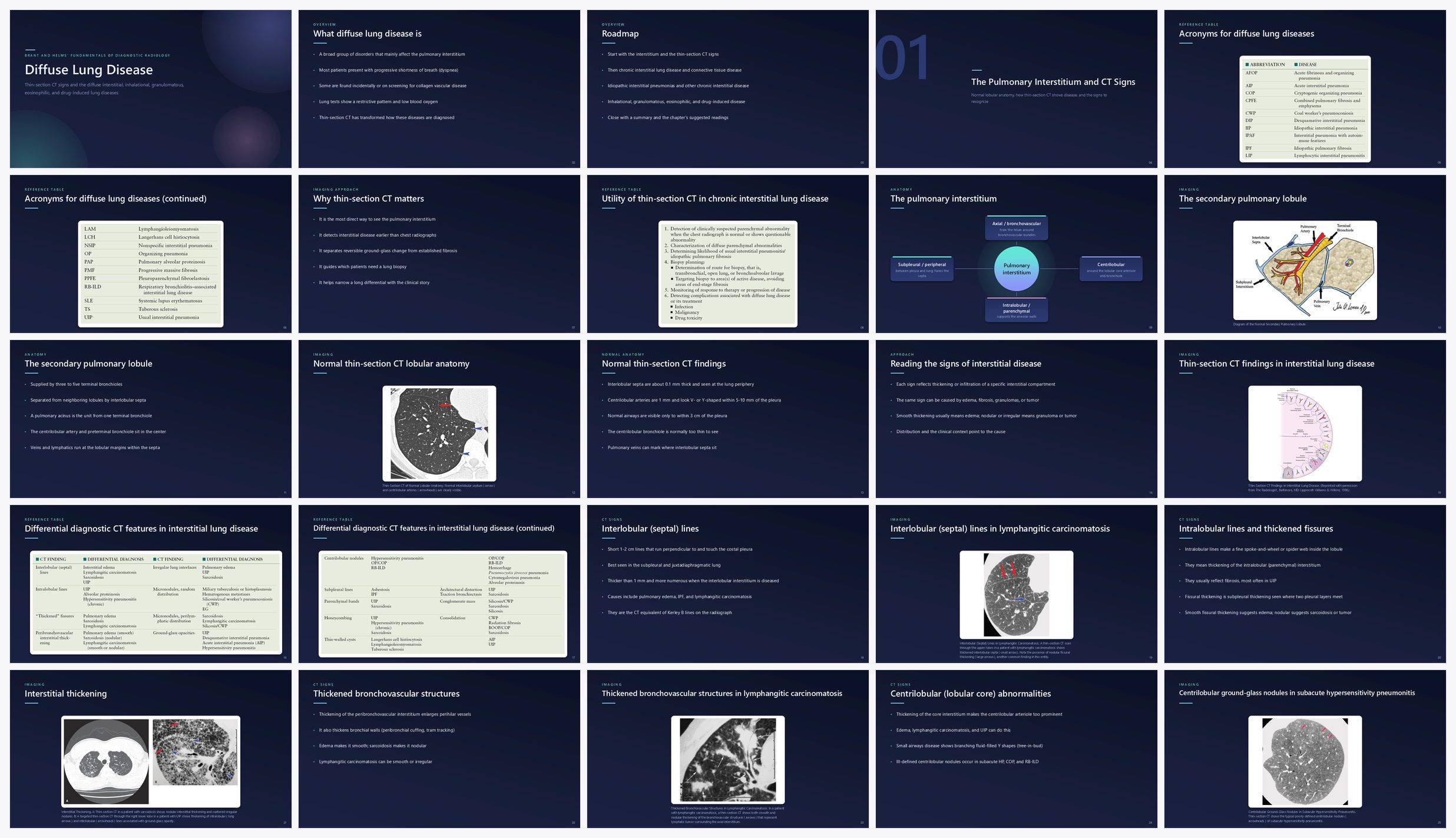 Preview of the first 25 slides of Diffuse Lung Disease