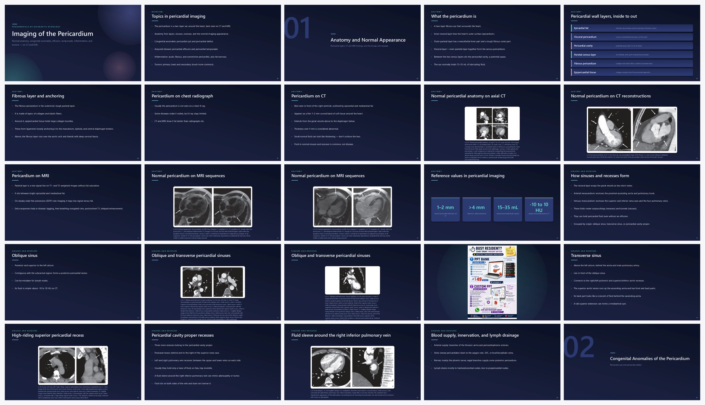 Preview of the first 25 slides of Imaging of the Pericardium