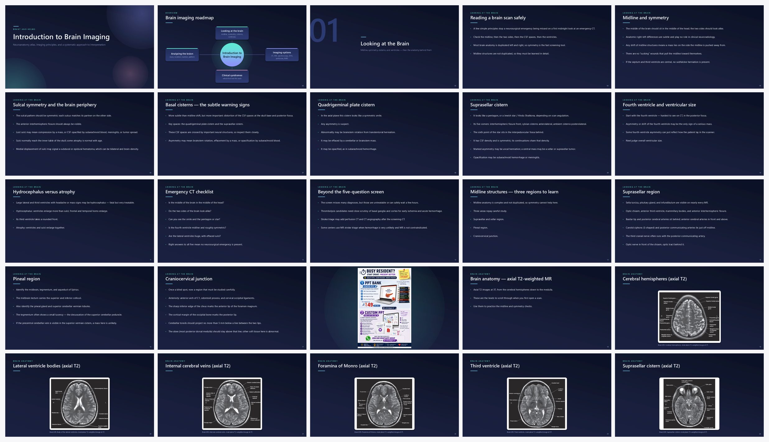 Preview of the first 25 slides of Introduction to Brain Imaging