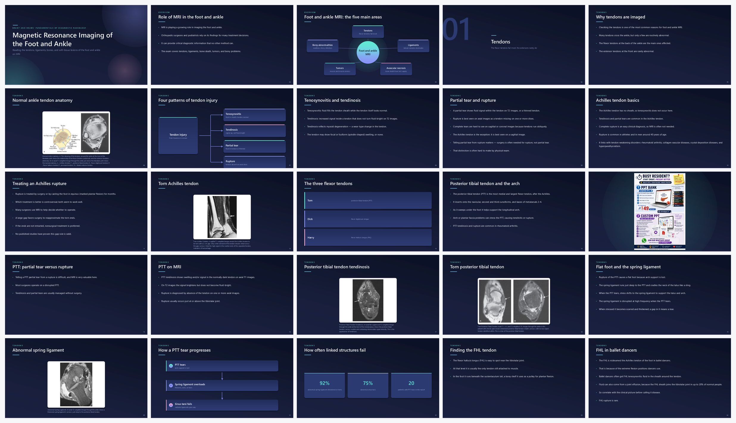 Preview of the first 25 slides of Magnetic Resonance Imaging of the Foot and Ankle