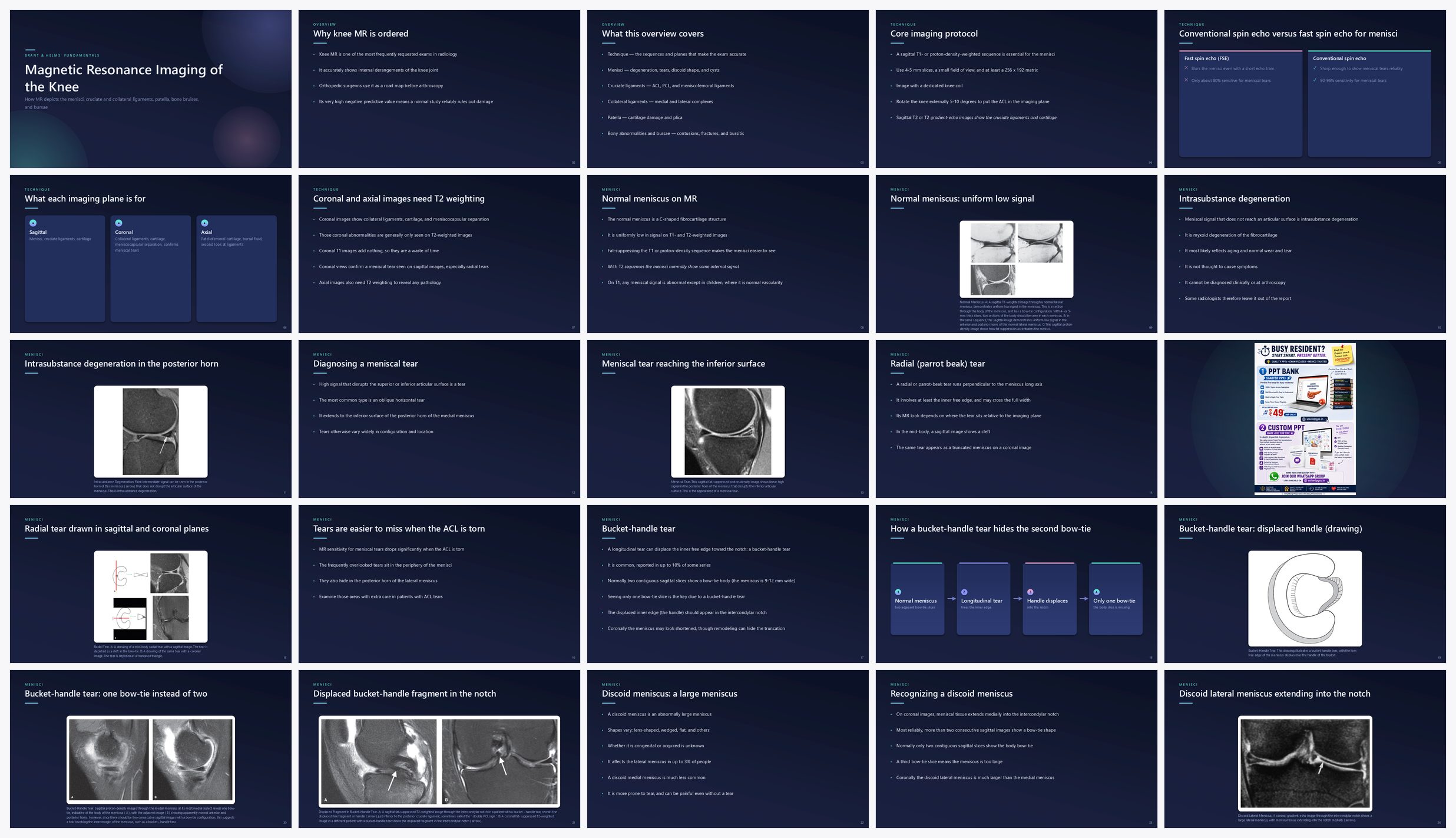 Preview of the first 25 slides of Magnetic Resonance Imaging of the Knee