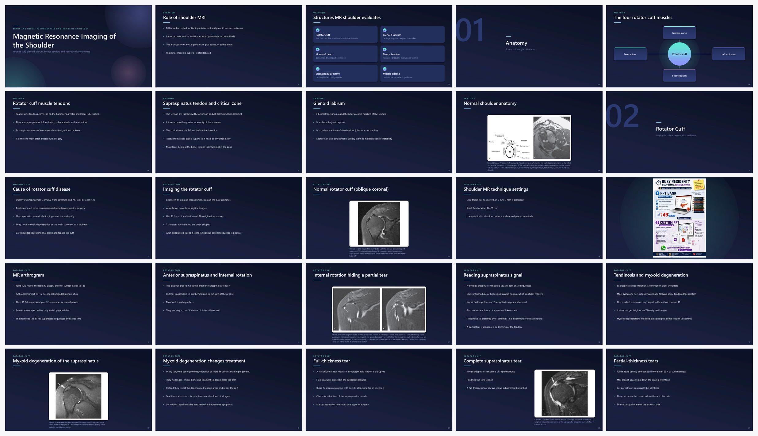 Preview of the first 25 slides of Magnetic Resonance Imaging of the Shoulder