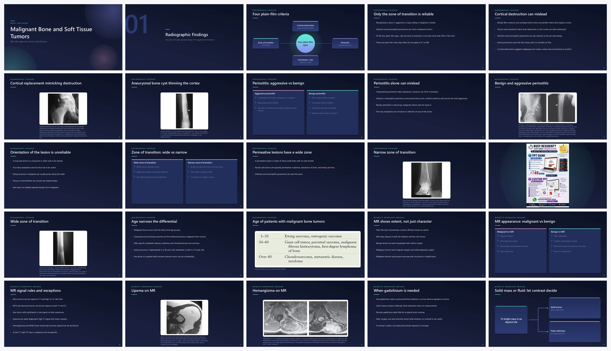 Preview of the first 25 slides of Malignant Bone and Soft Tissue Tumors