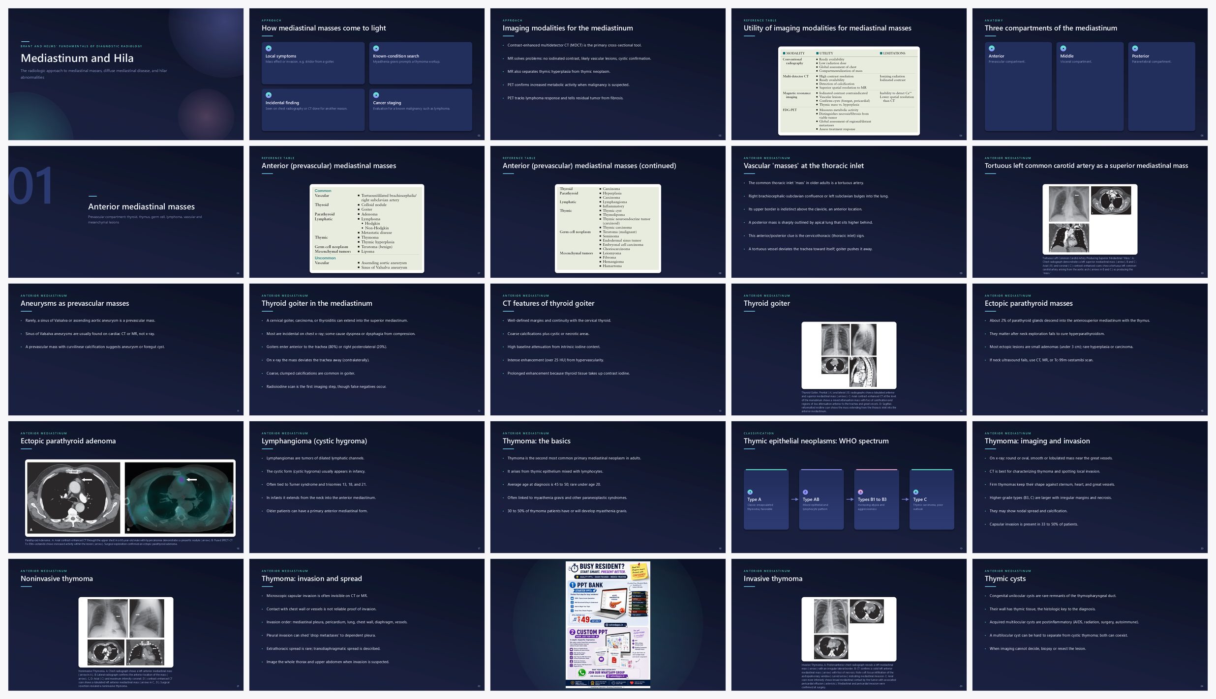 Preview of the first 25 slides of Mediastinum and Hila