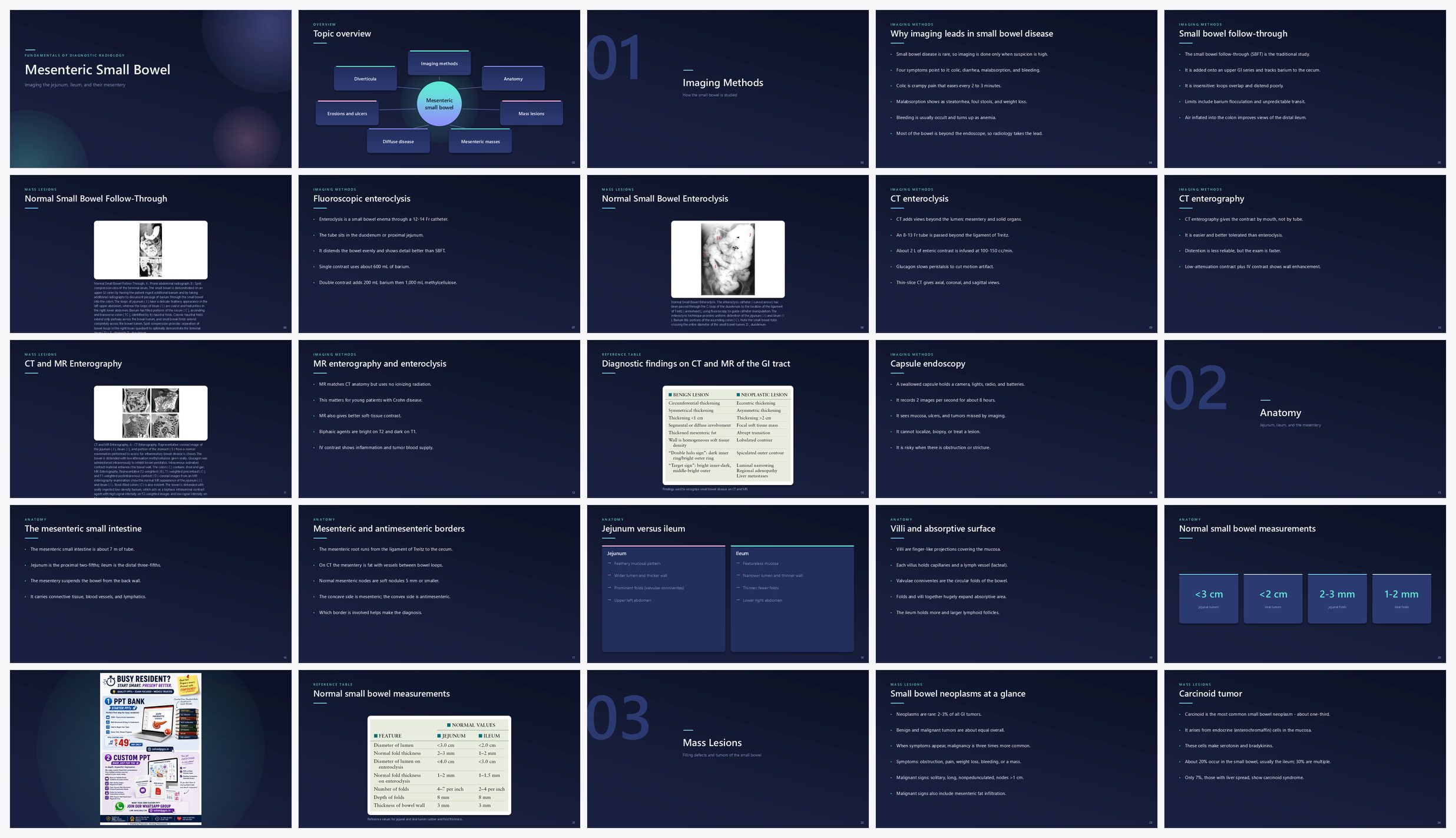 Preview of the first 25 slides of Mesenteric Small Bowel