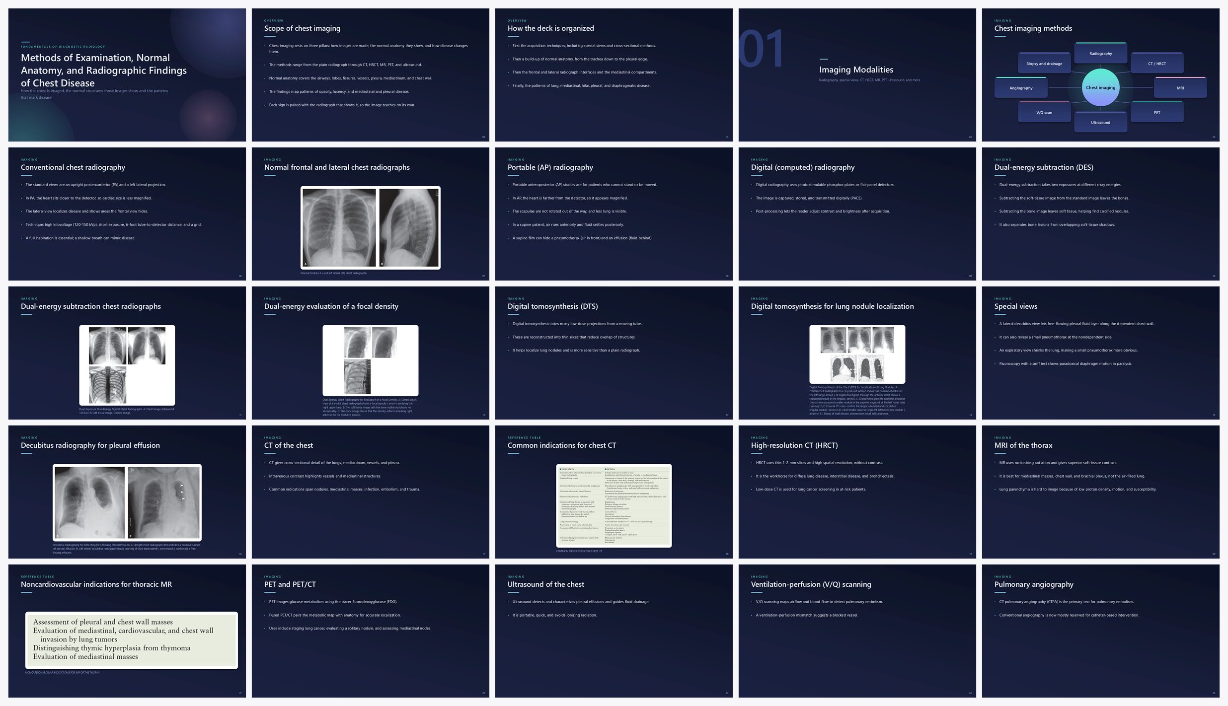 Preview of the first 25 slides of Methods of Examination, Normal Anatomy, and Radiographic Findings of Chest Disease