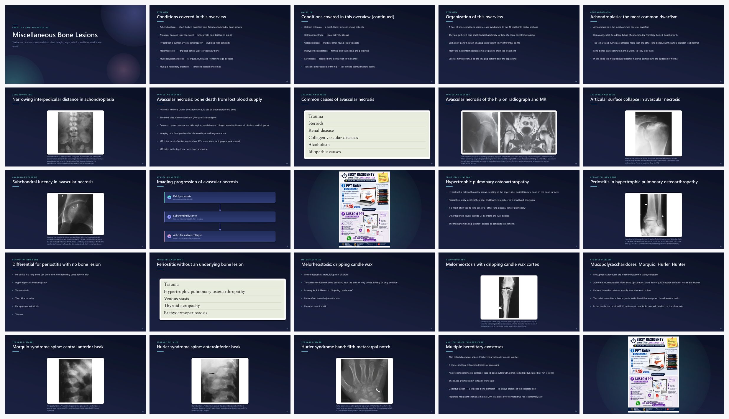 Preview of the first 25 slides of Miscellaneous Bone Lesions