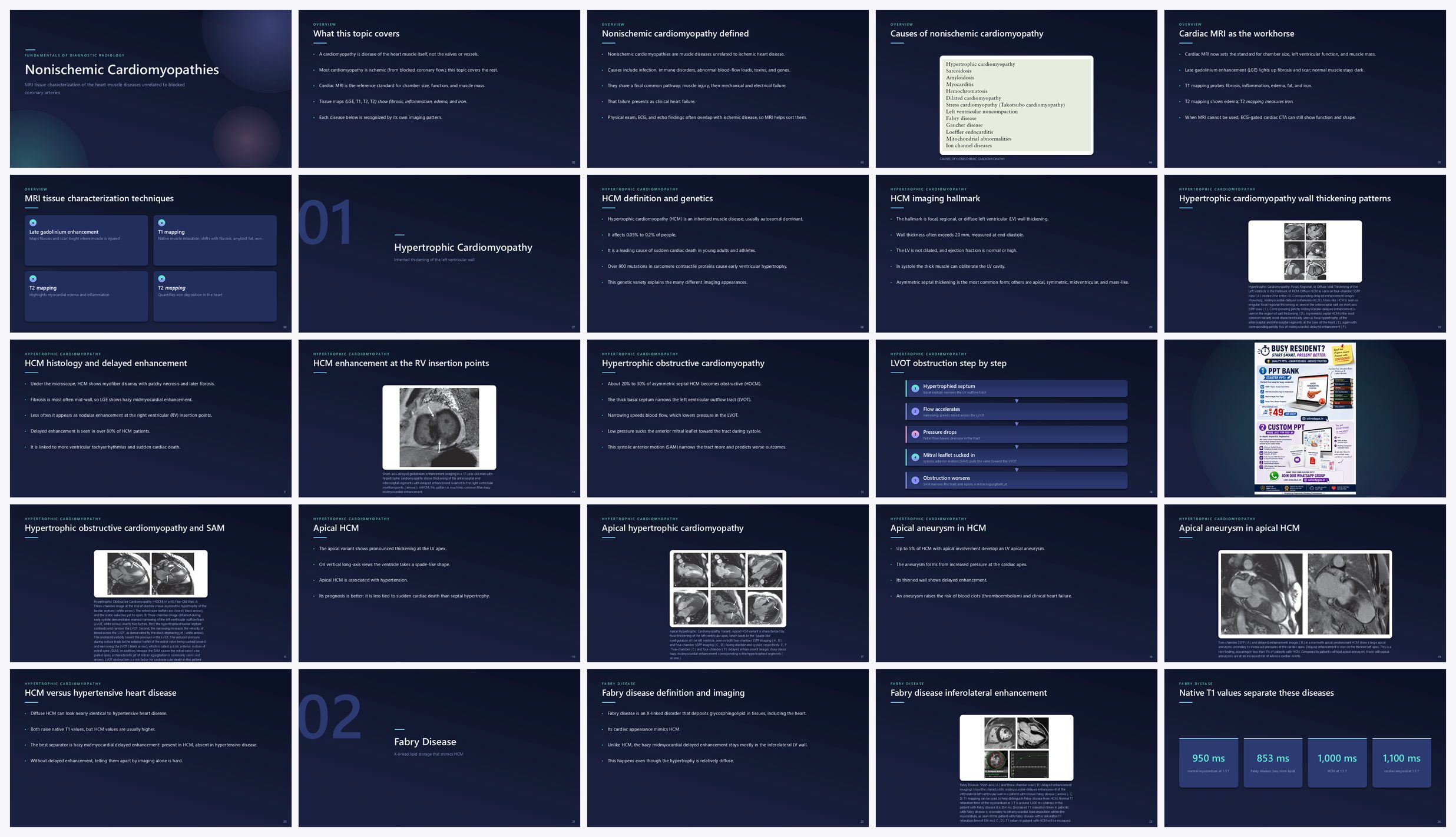 Preview of the first 25 slides of Nonischemic Cardiomyopathies