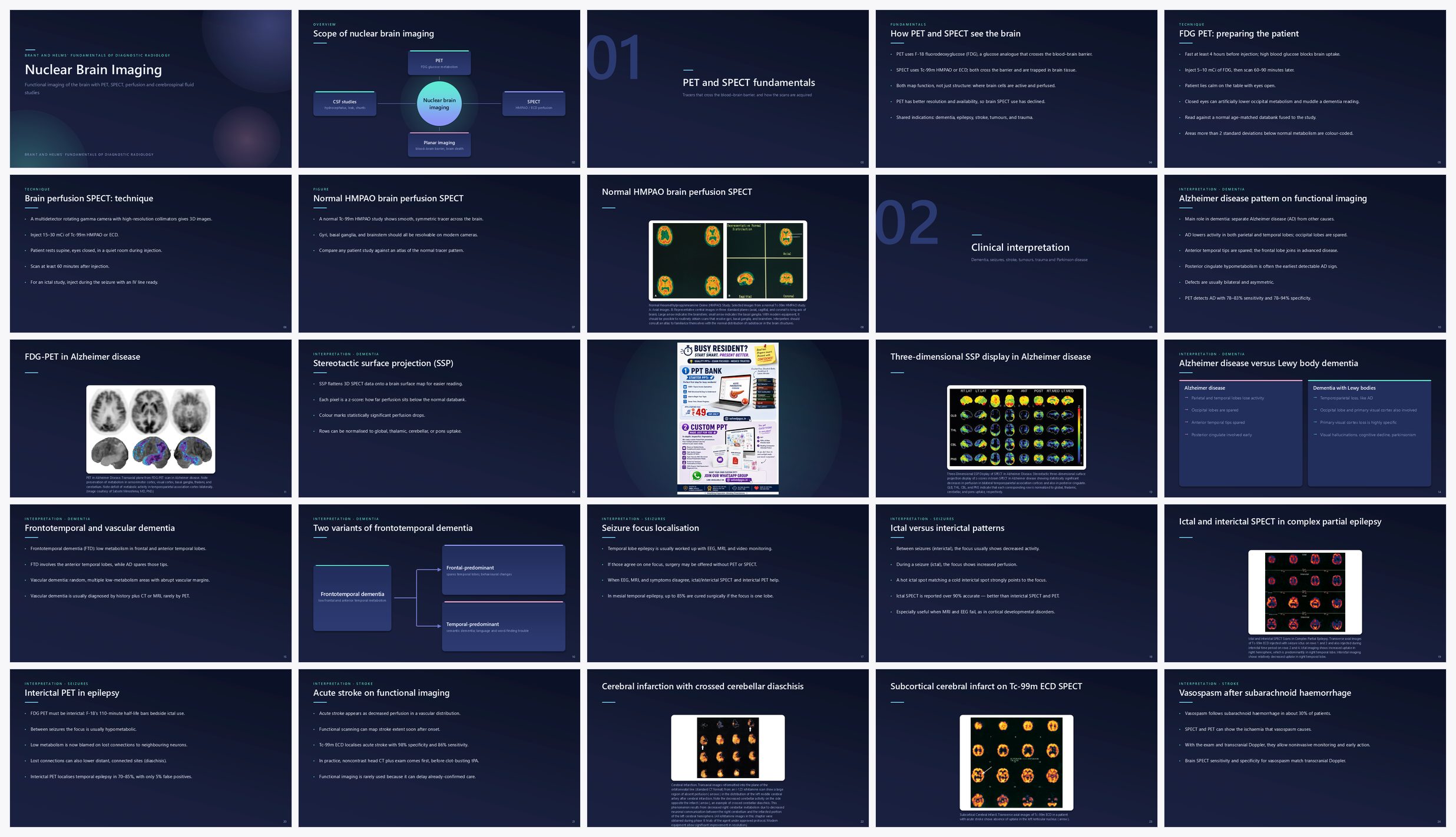 Preview of the first 25 slides of Nuclear Brain Imaging