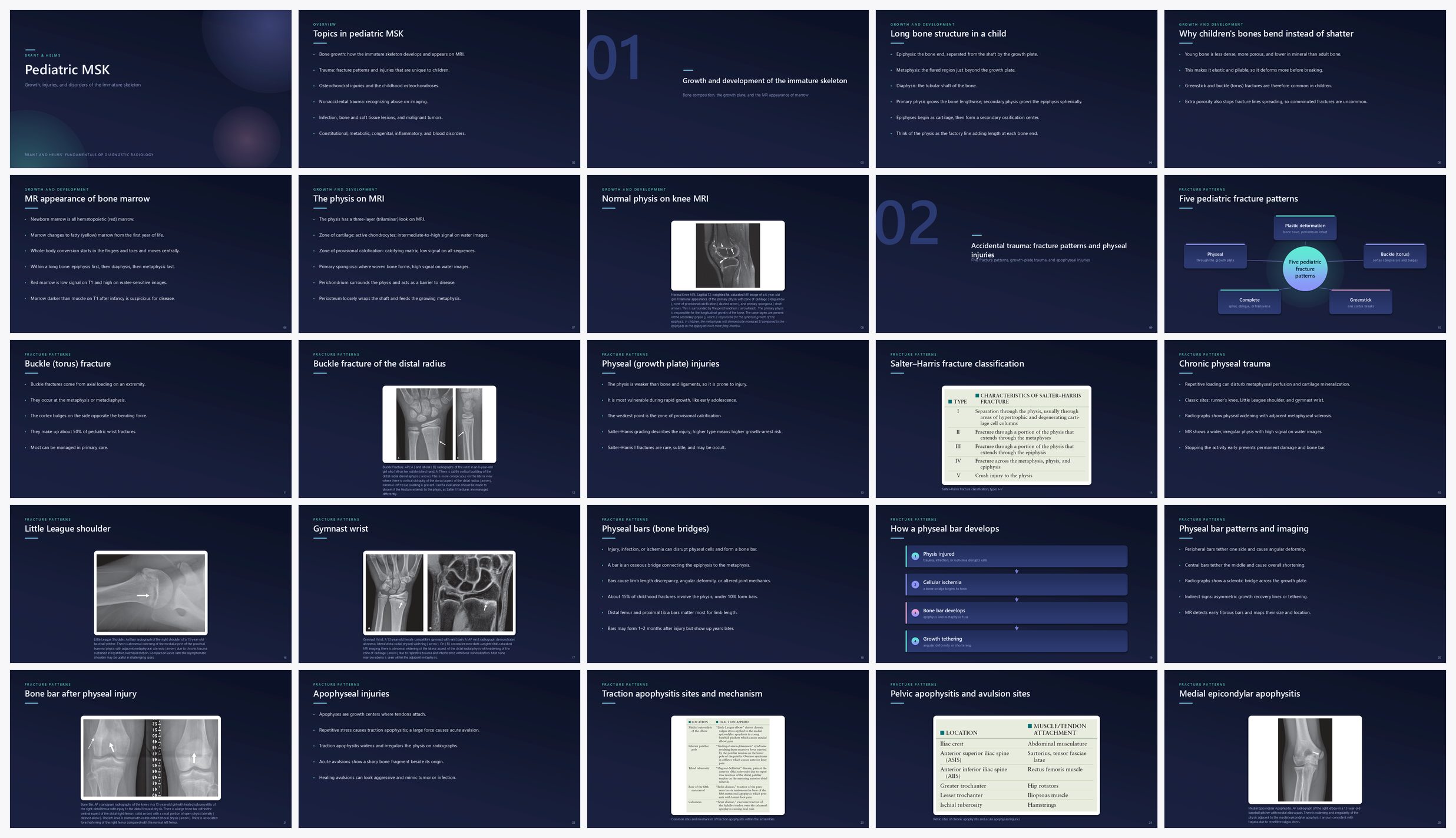Preview of the first 25 slides of Pediatric MSK