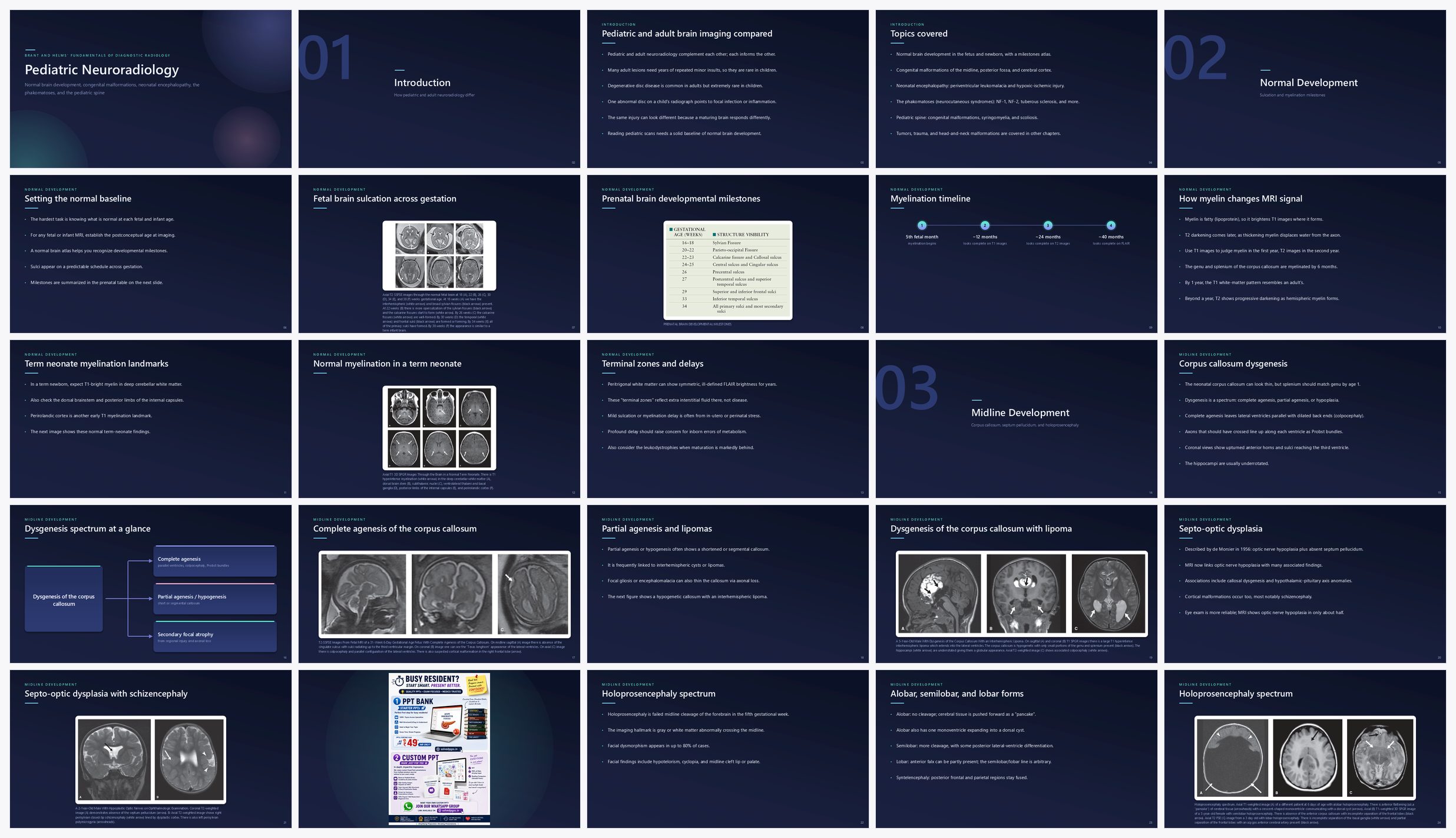Preview of the first 25 slides of Pediatric Neuroradiology