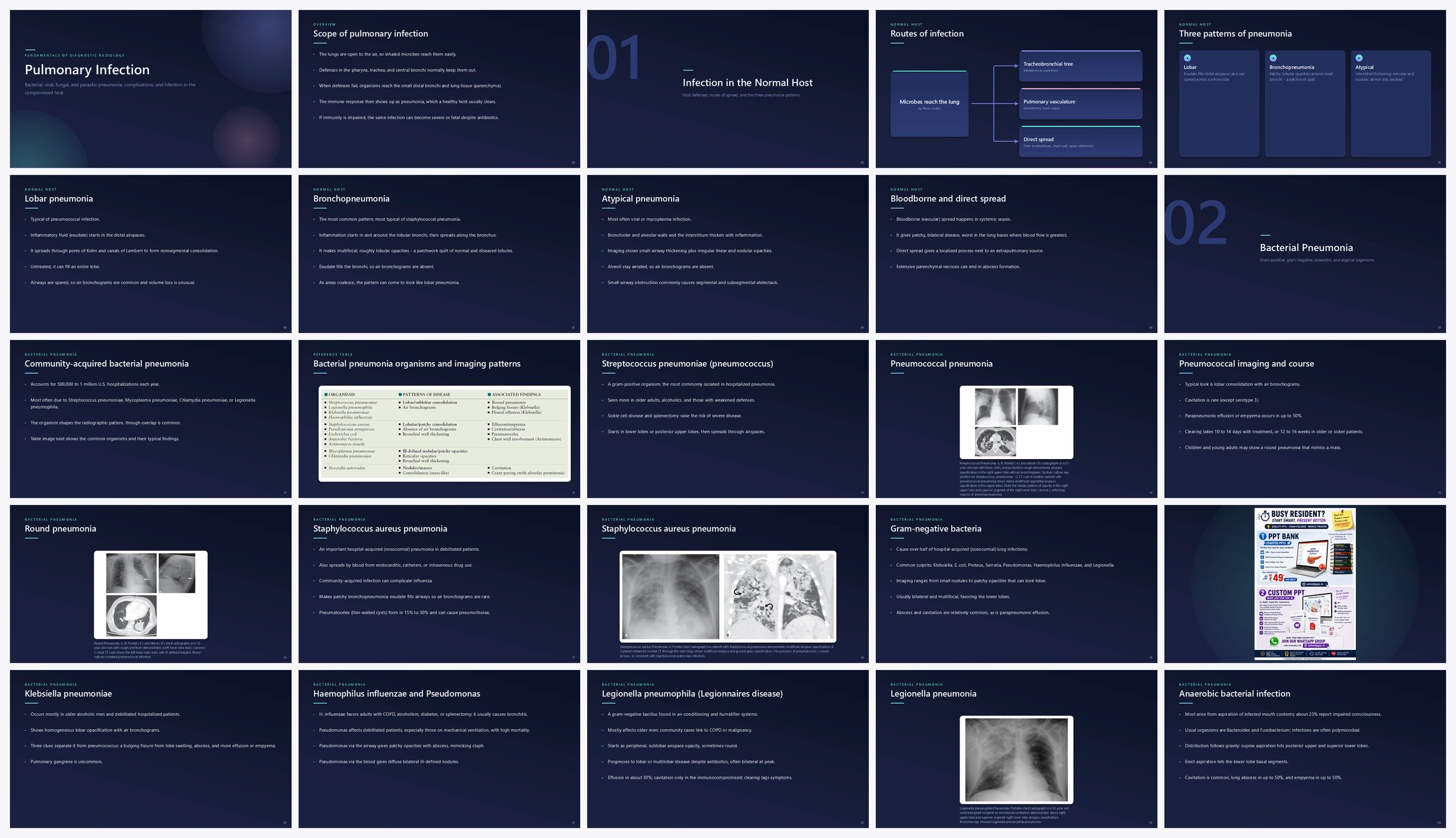 Preview of the first 25 slides of Pulmonary Infection