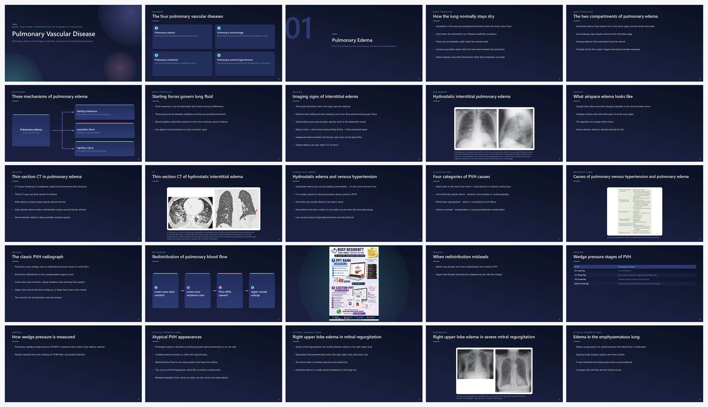 Preview of the first 25 slides of Pulmonary Vascular Disease