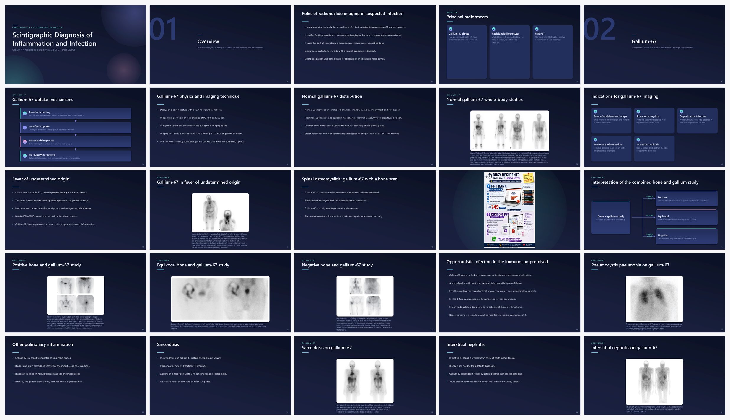 Preview of the first 25 slides of Scintigraphic Diagnosis of Inflammation and Infection