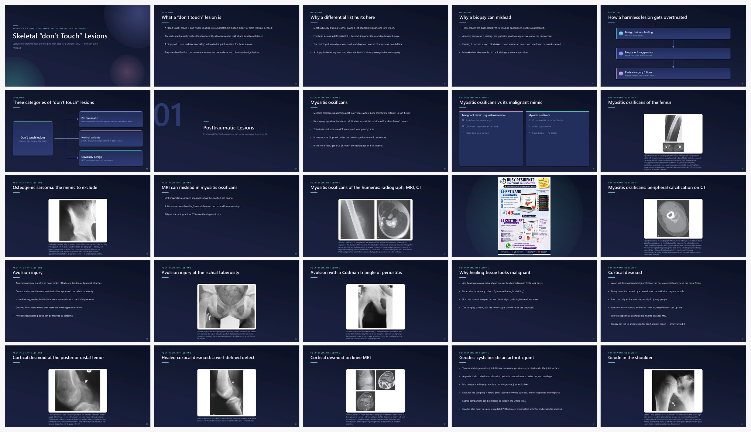 Preview of the first 25 slides of Skeletal “don’t Touch” Lesions