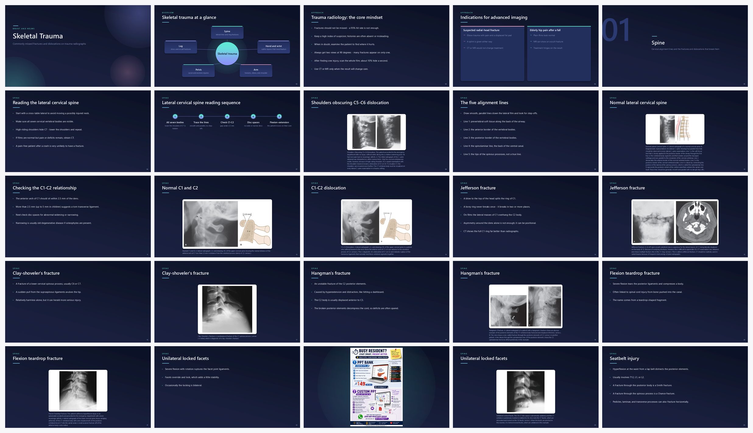 Preview of the first 25 slides of Skeletal Trauma