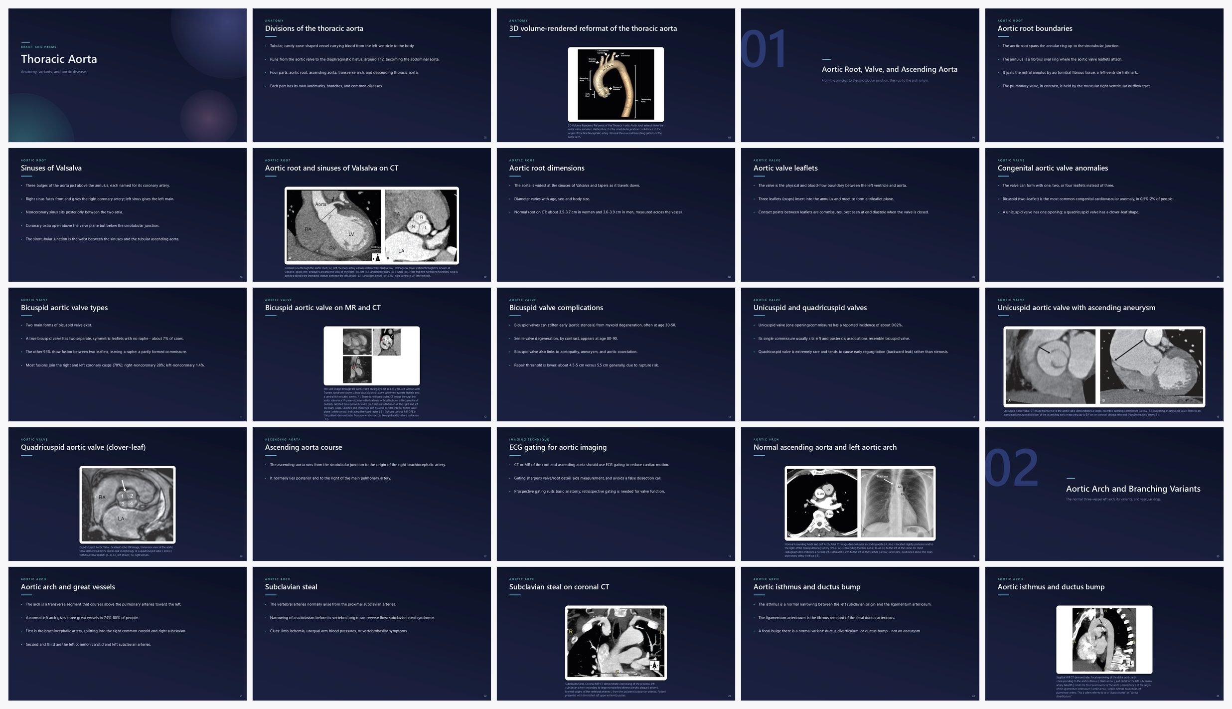 Preview of the first 25 slides of Thoracic Aorta