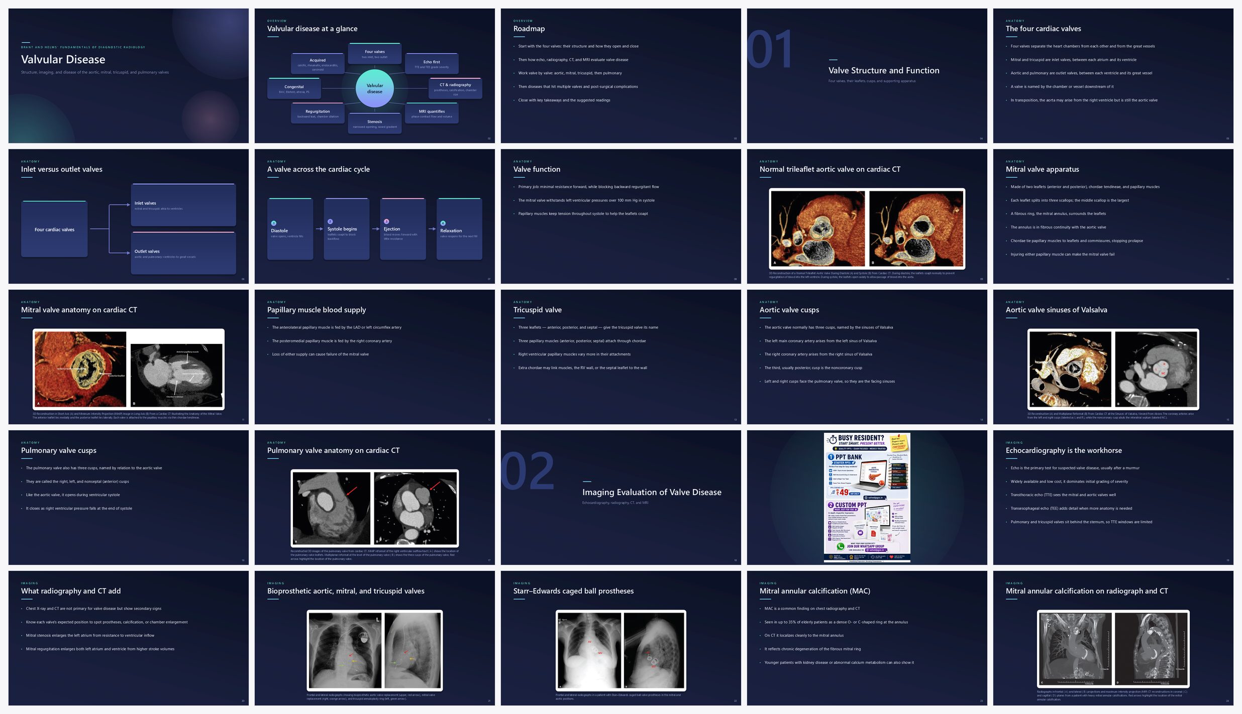 Preview of the first 25 slides of Valvular Disease